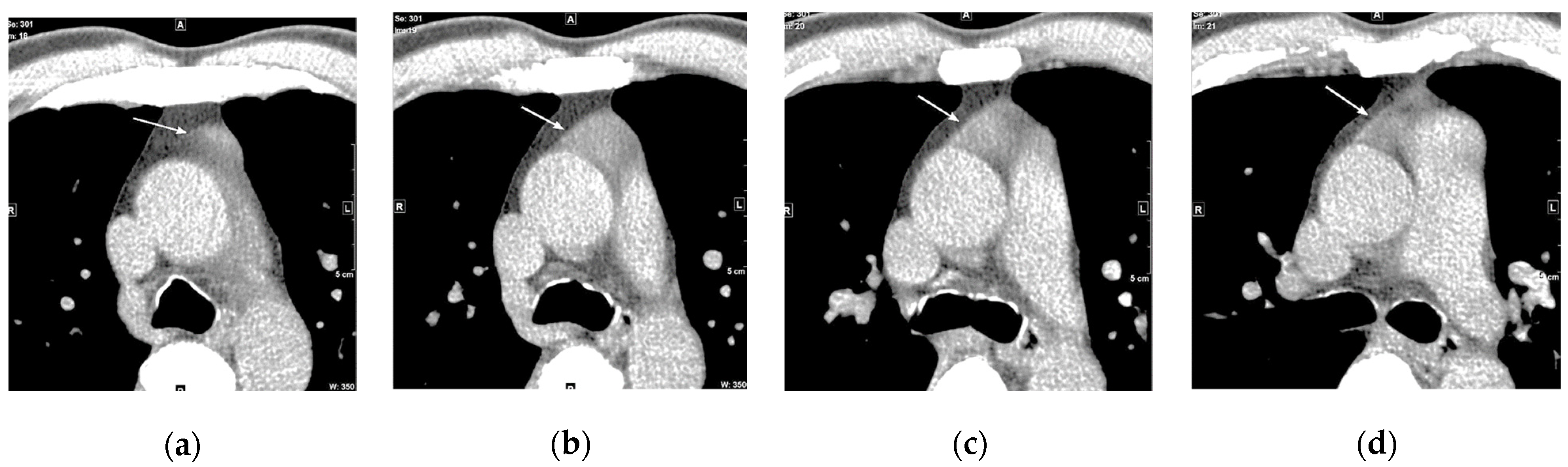 Cancers 16 02600 g009