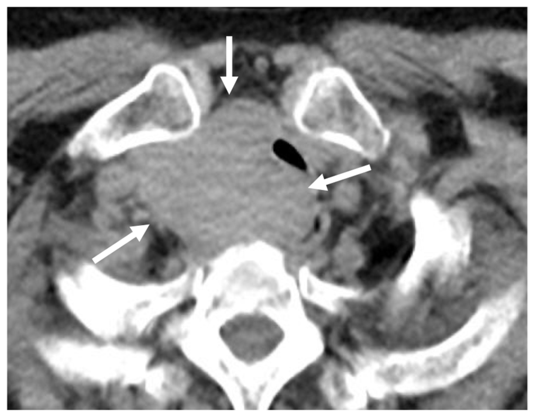 Cancers 16 02600 g012