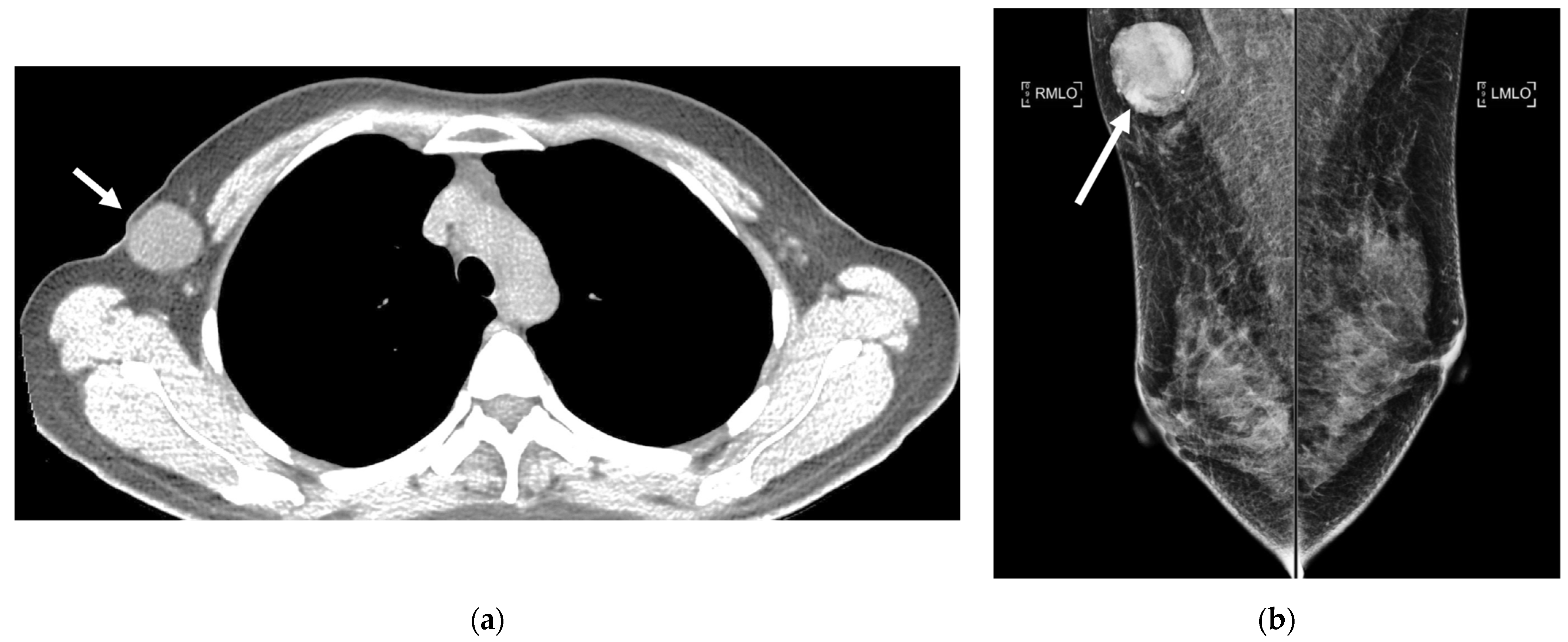 Cancers 16 02600 g014