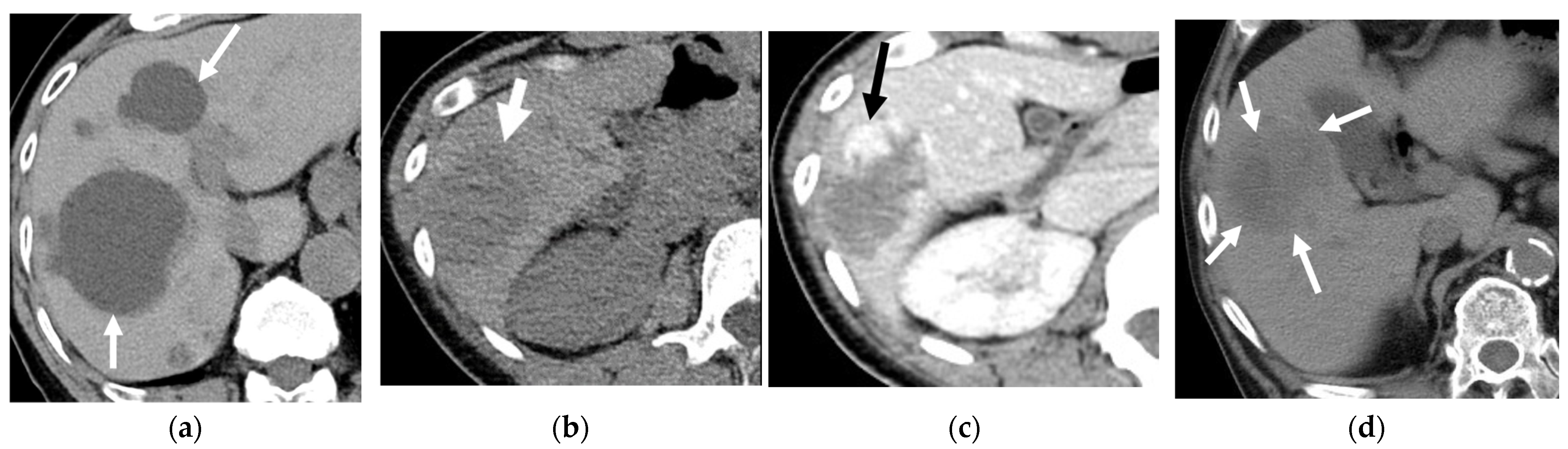 Cancers 16 02600 g015