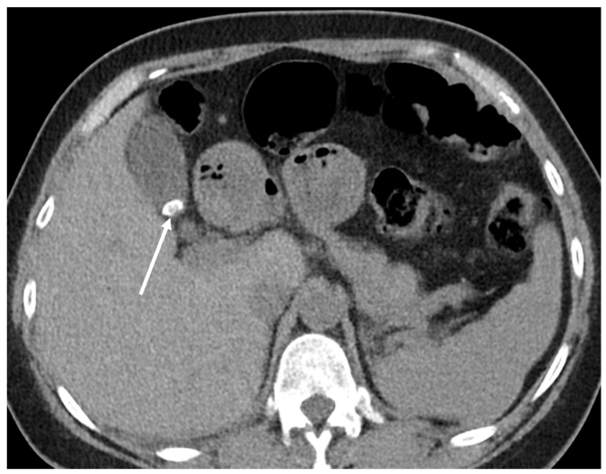 Cancers 16 02600 g017