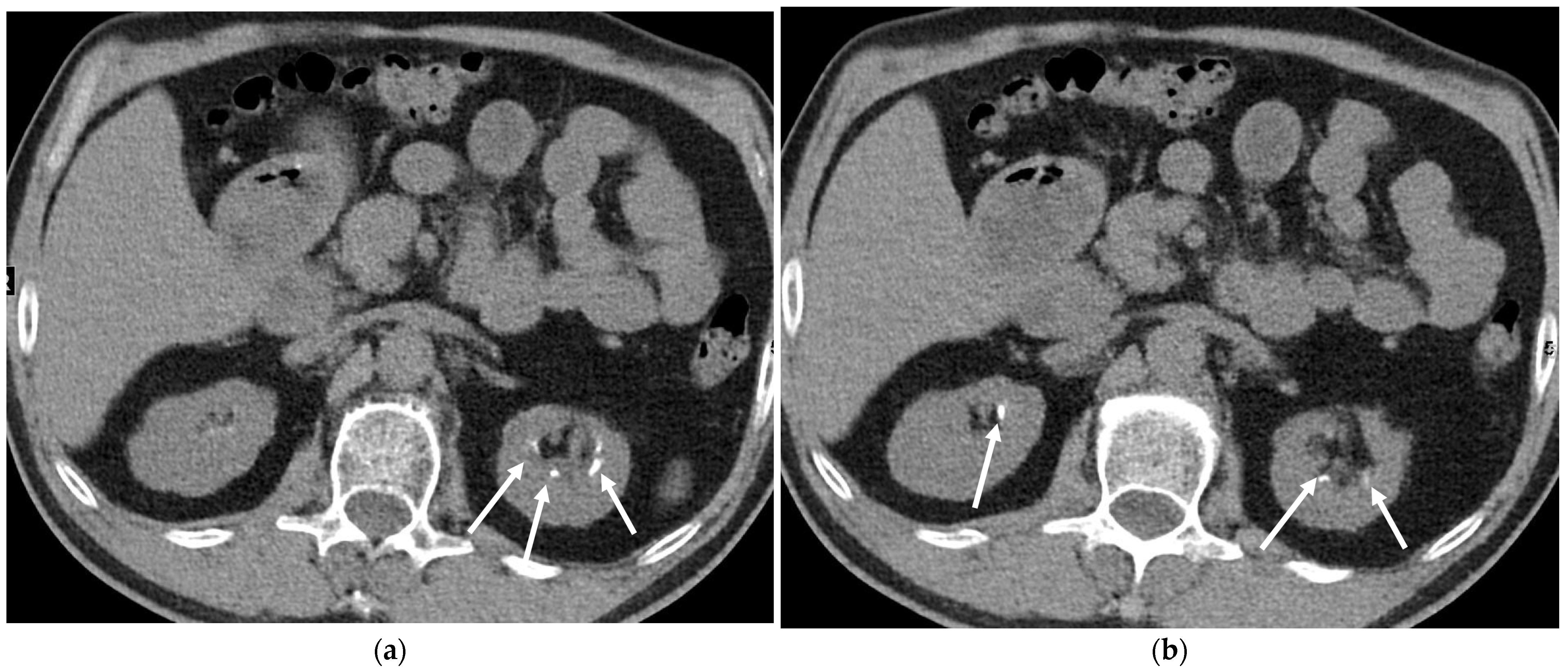 Cancers 16 02600 g019