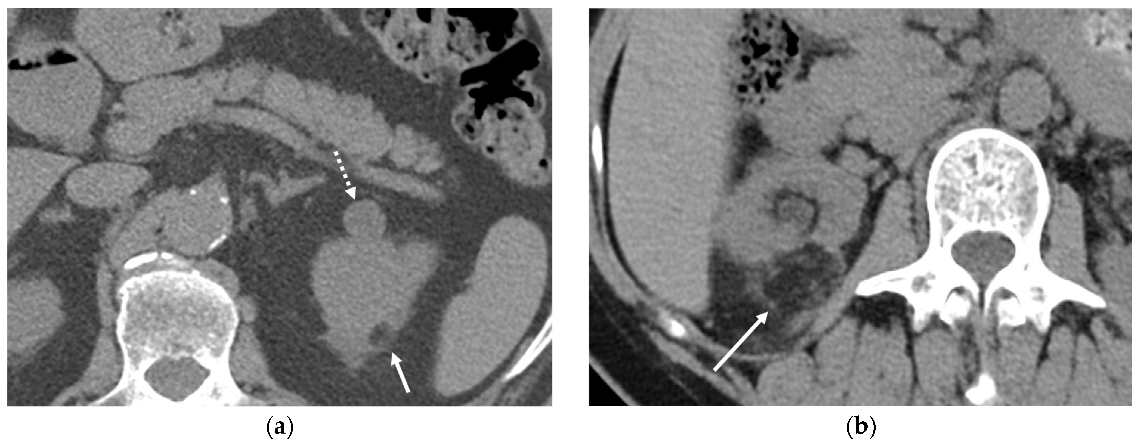 Cancers 16 02600 g020