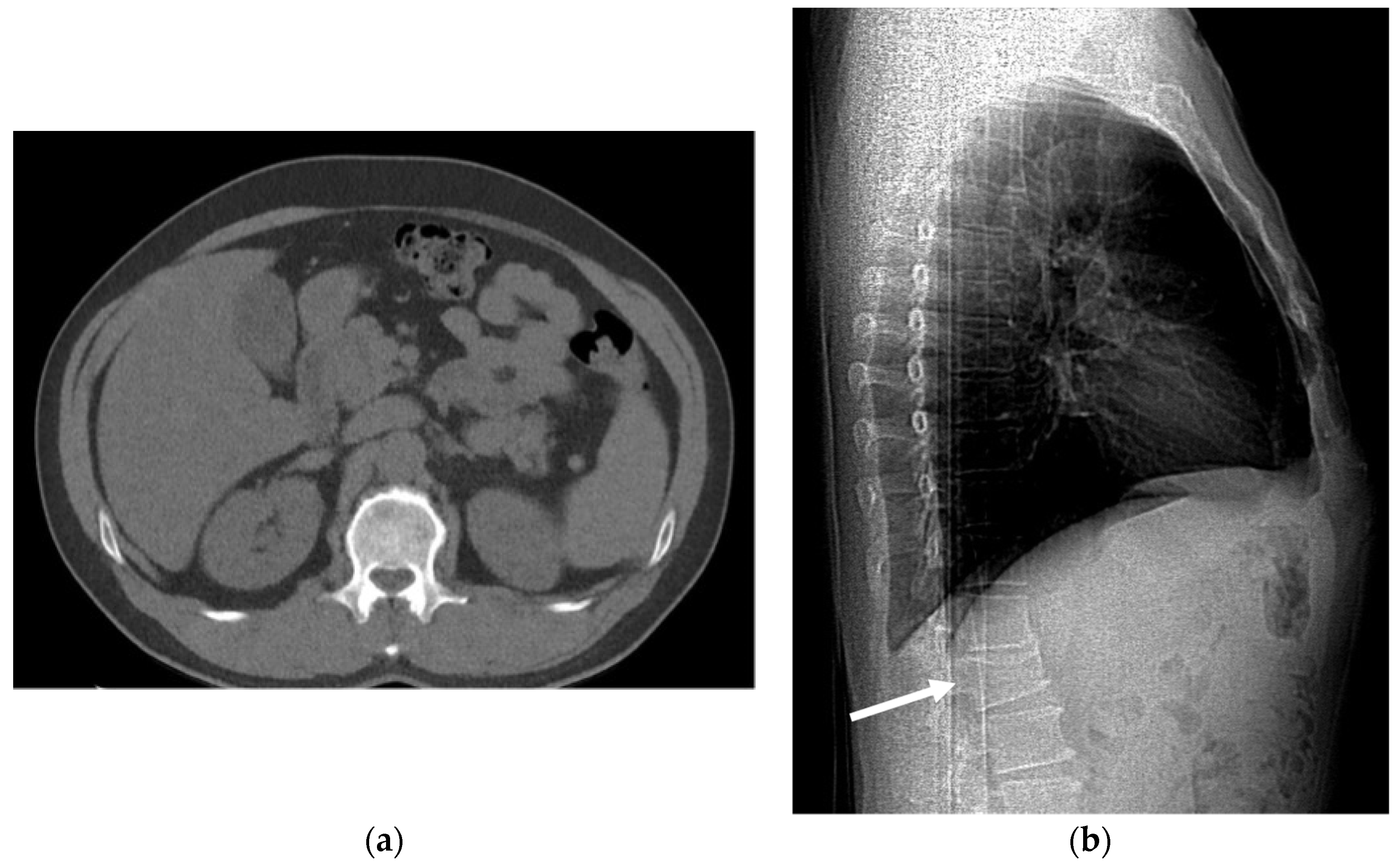 Cancers 16 02600 g021