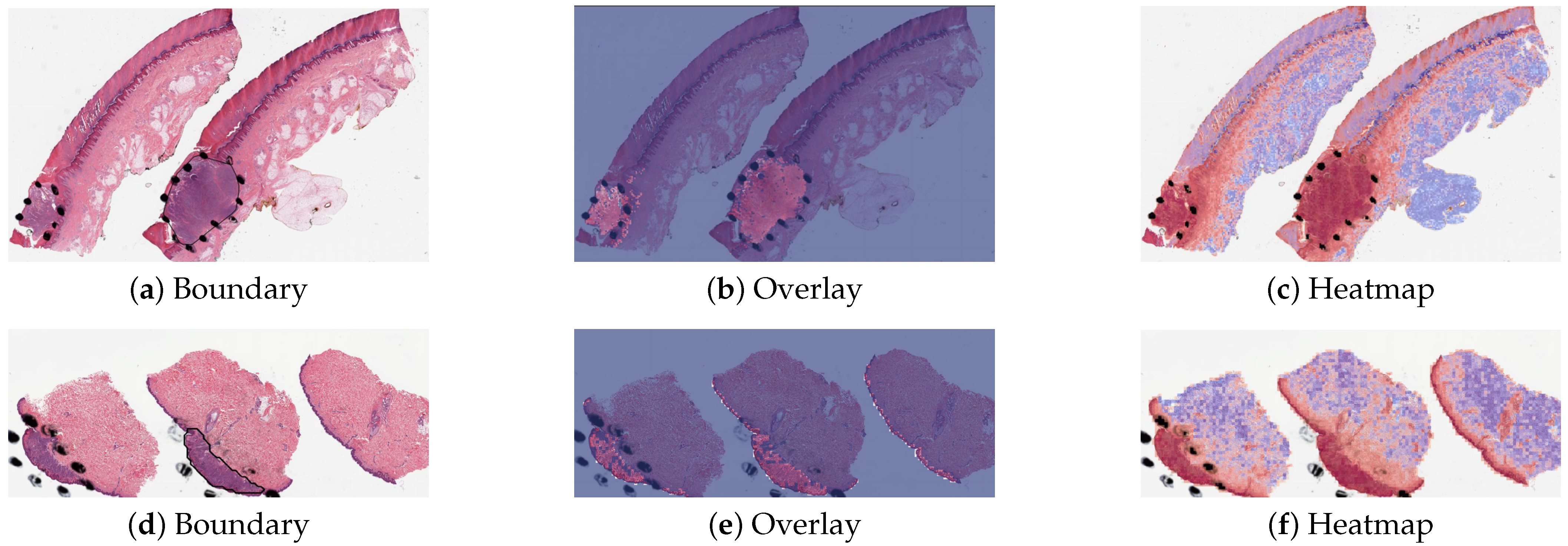 Cancers 16 02616 g003