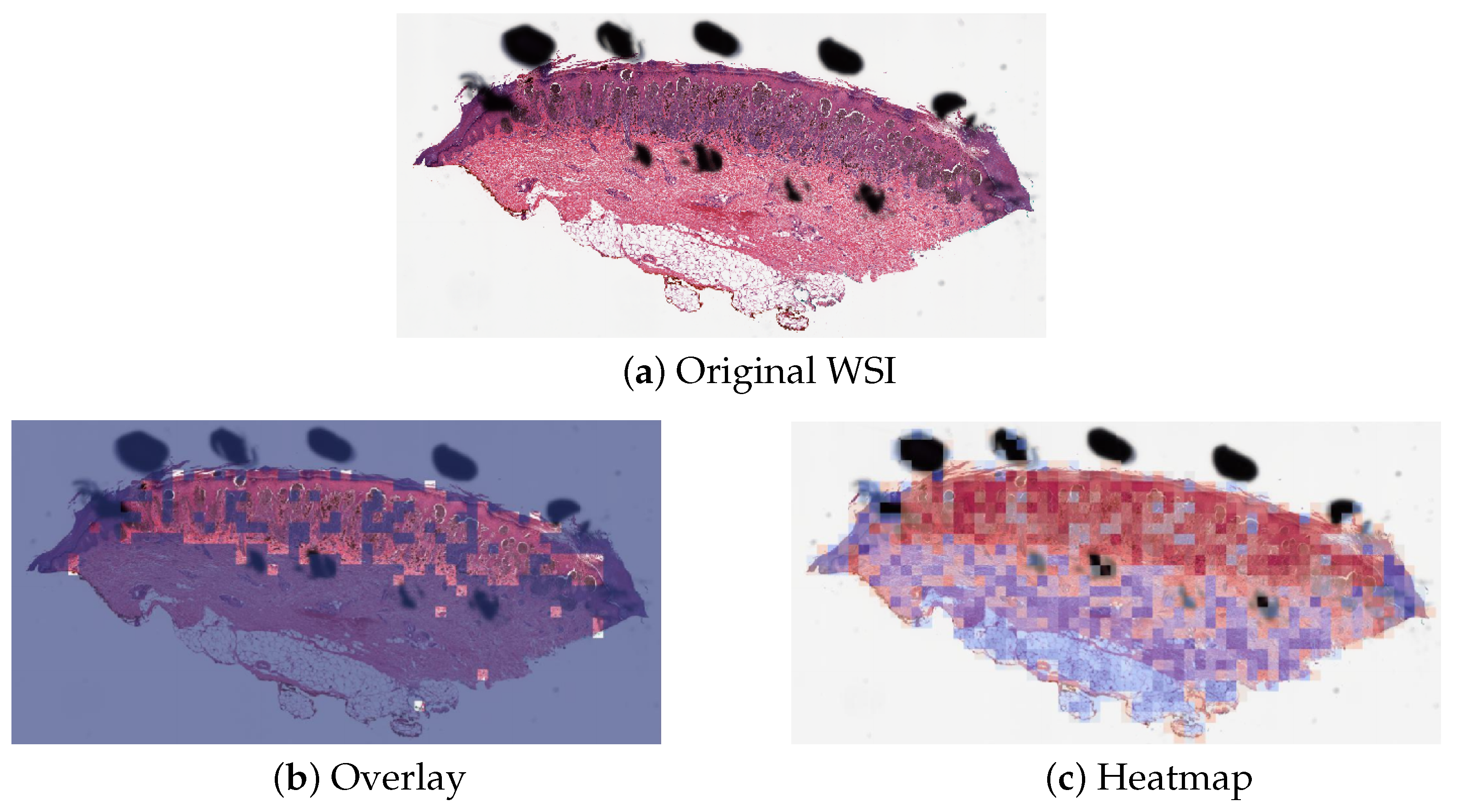 Cancers 16 02616 g004