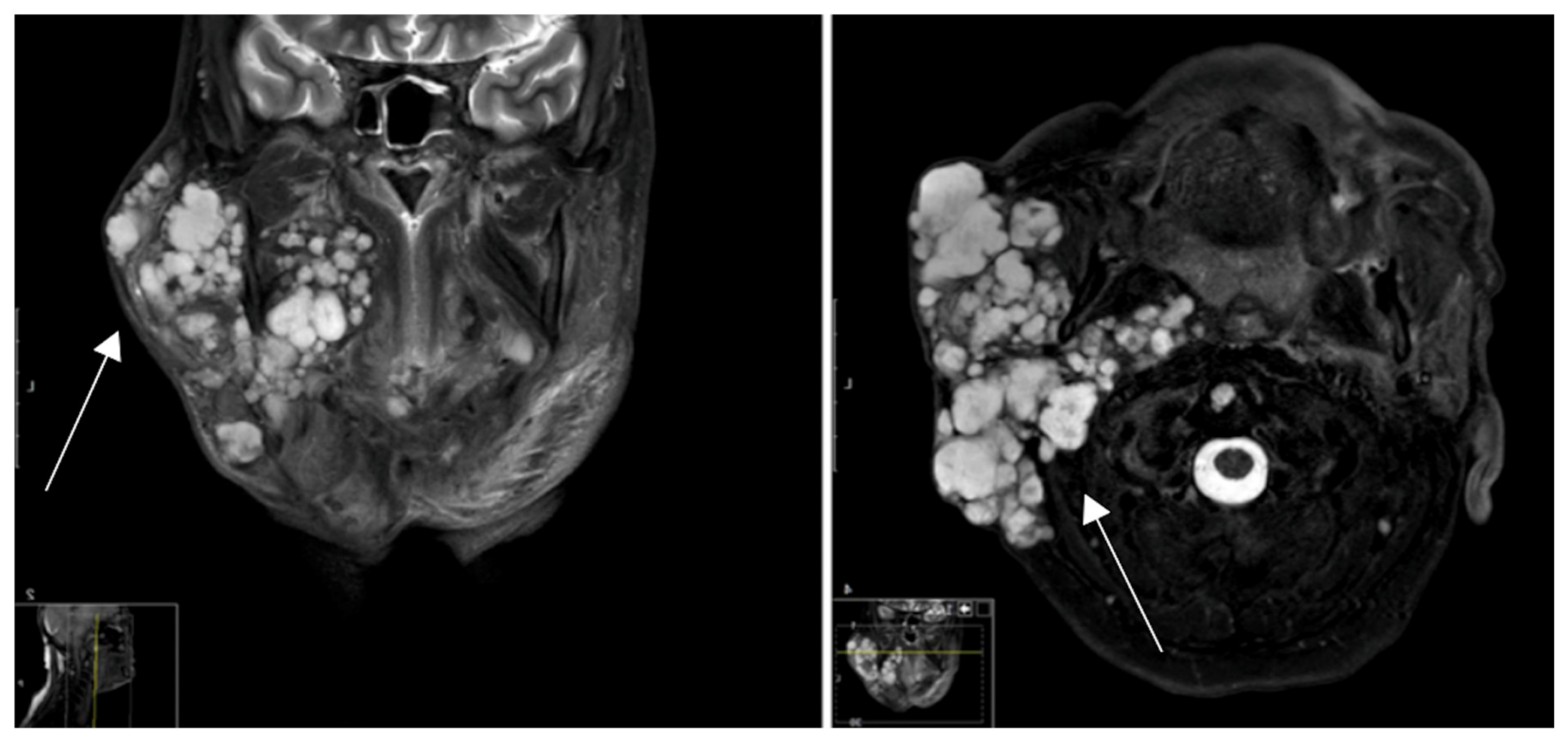 Cancers 16 02624 g001