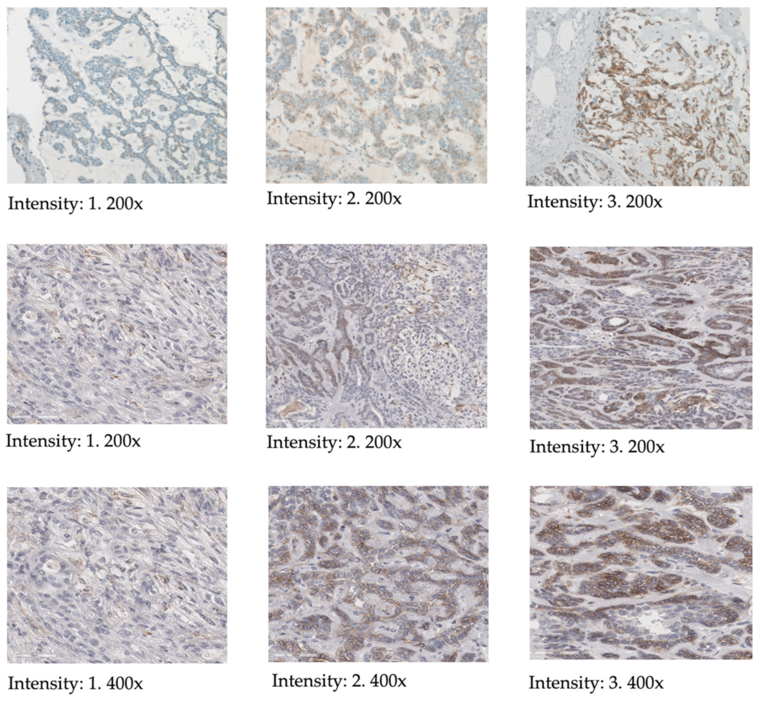 Cancers 16 02624 g002