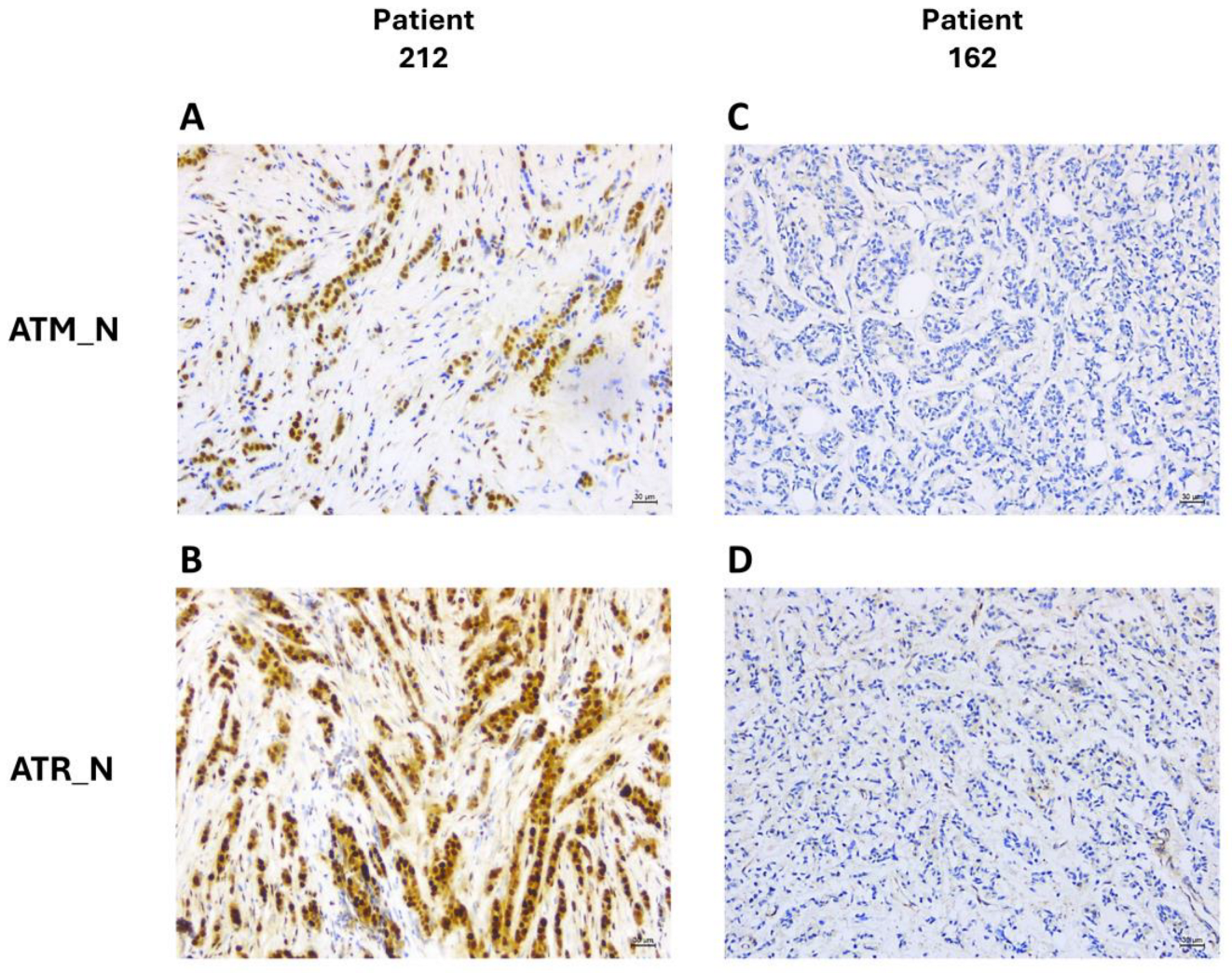 Cancers 16 02628 g007 Cancers 16 02628 g007