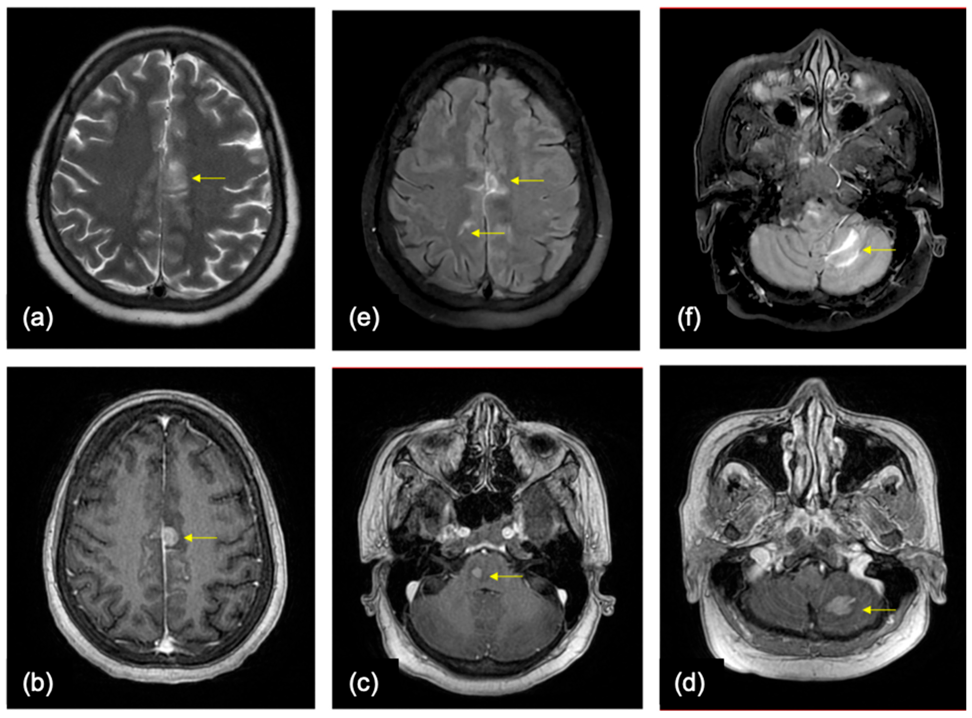 Cancers 16 02667 g004