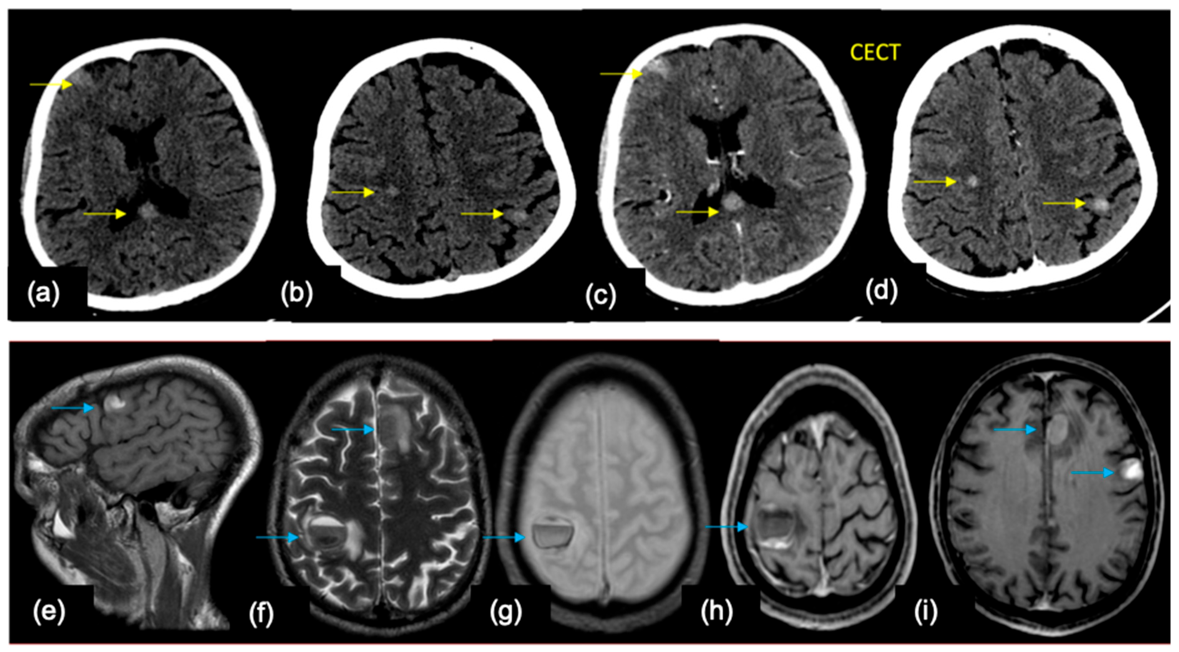 Cancers 16 02667 g005