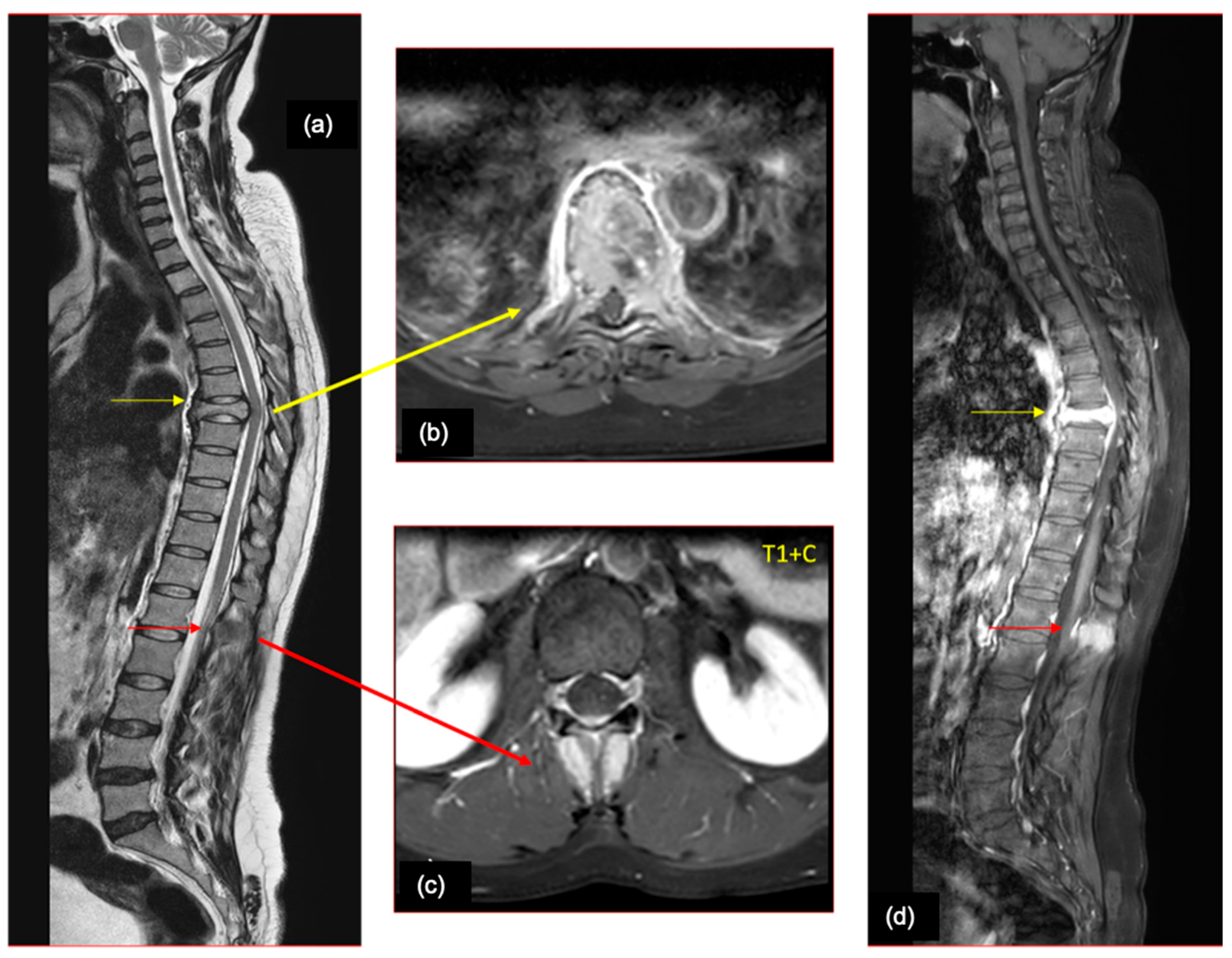 Cancers 16 02667 g006