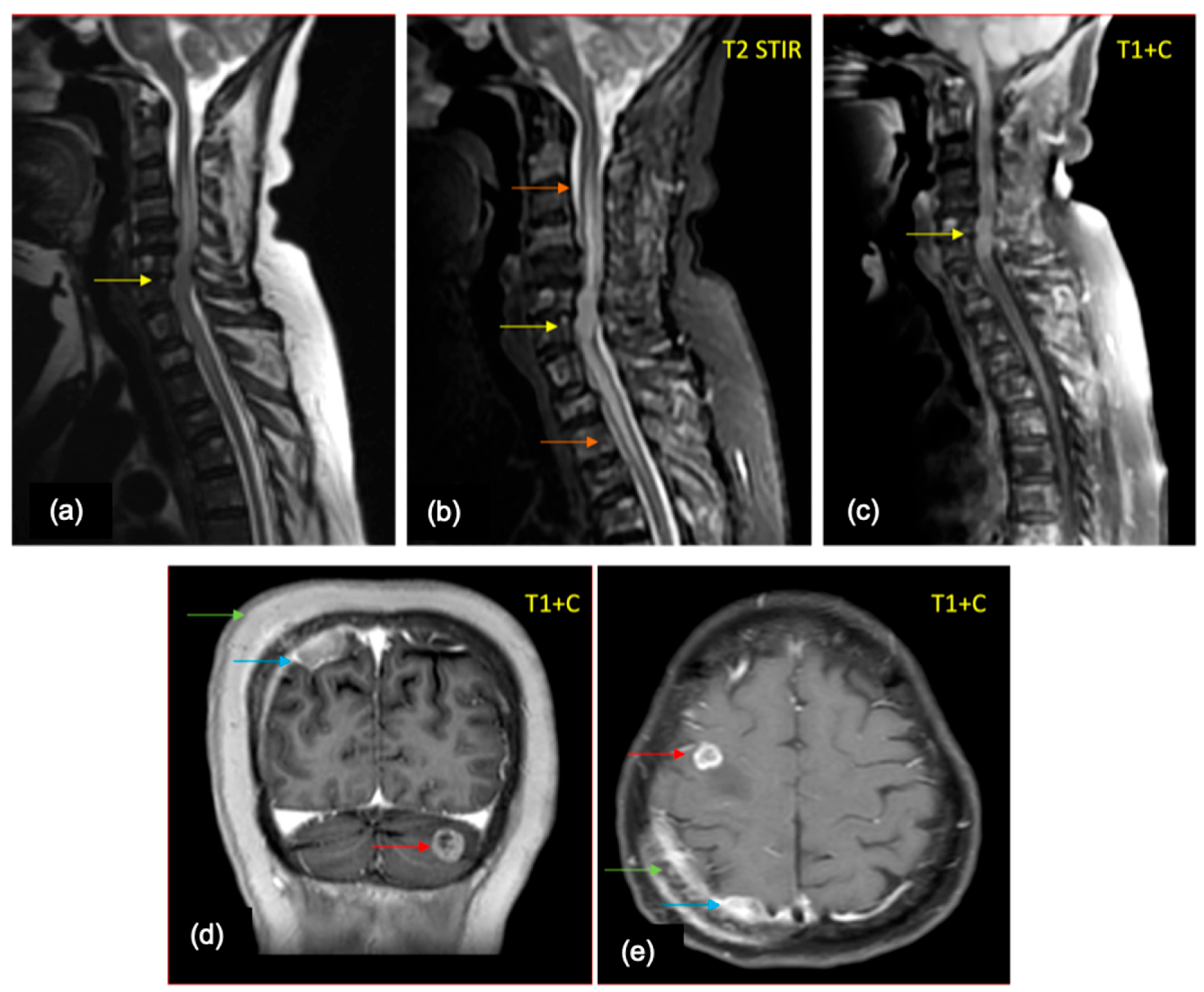 Cancers 16 02667 g007