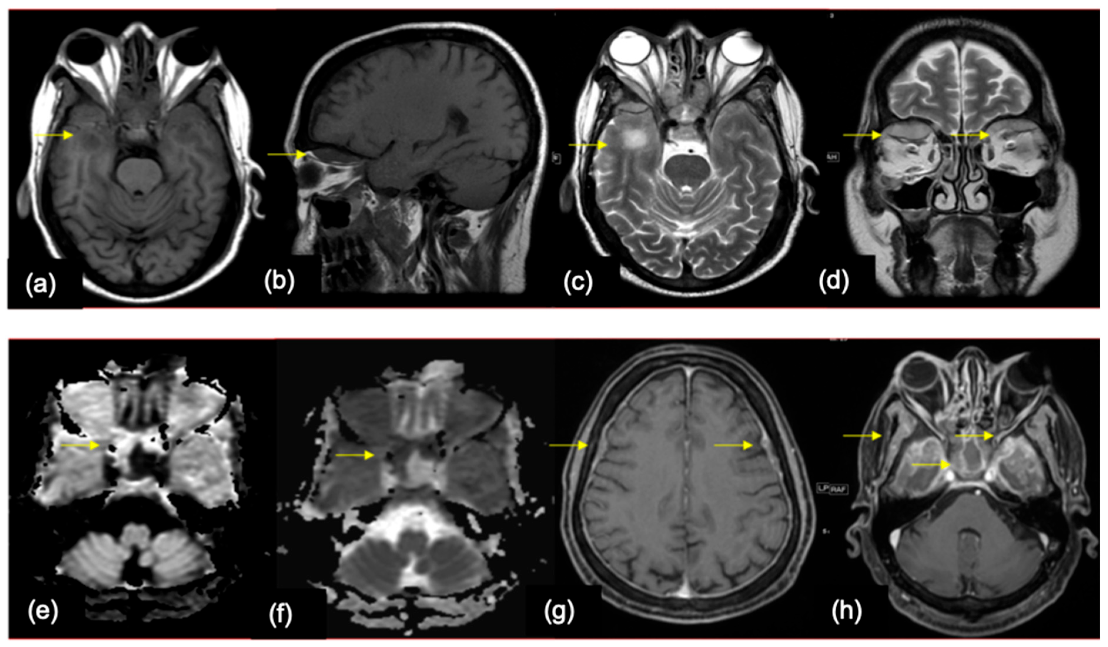 Cancers 16 02667 g008