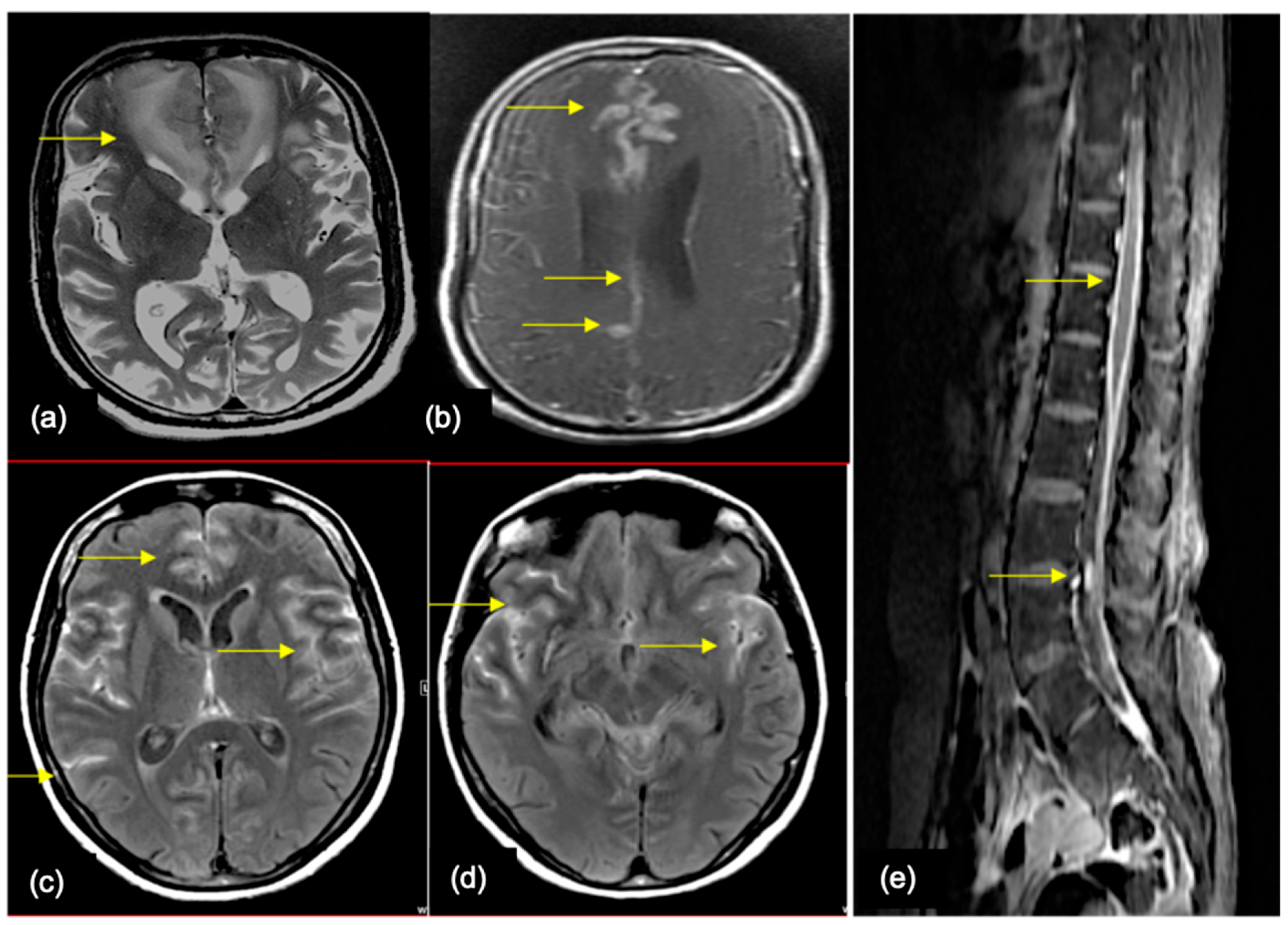 Cancers 16 02667 g009