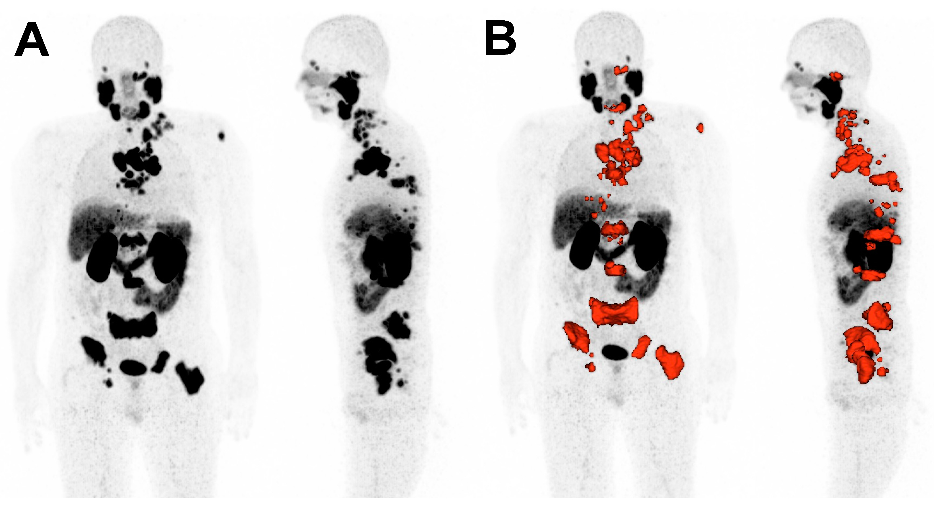 Cancers 16 02670 g001