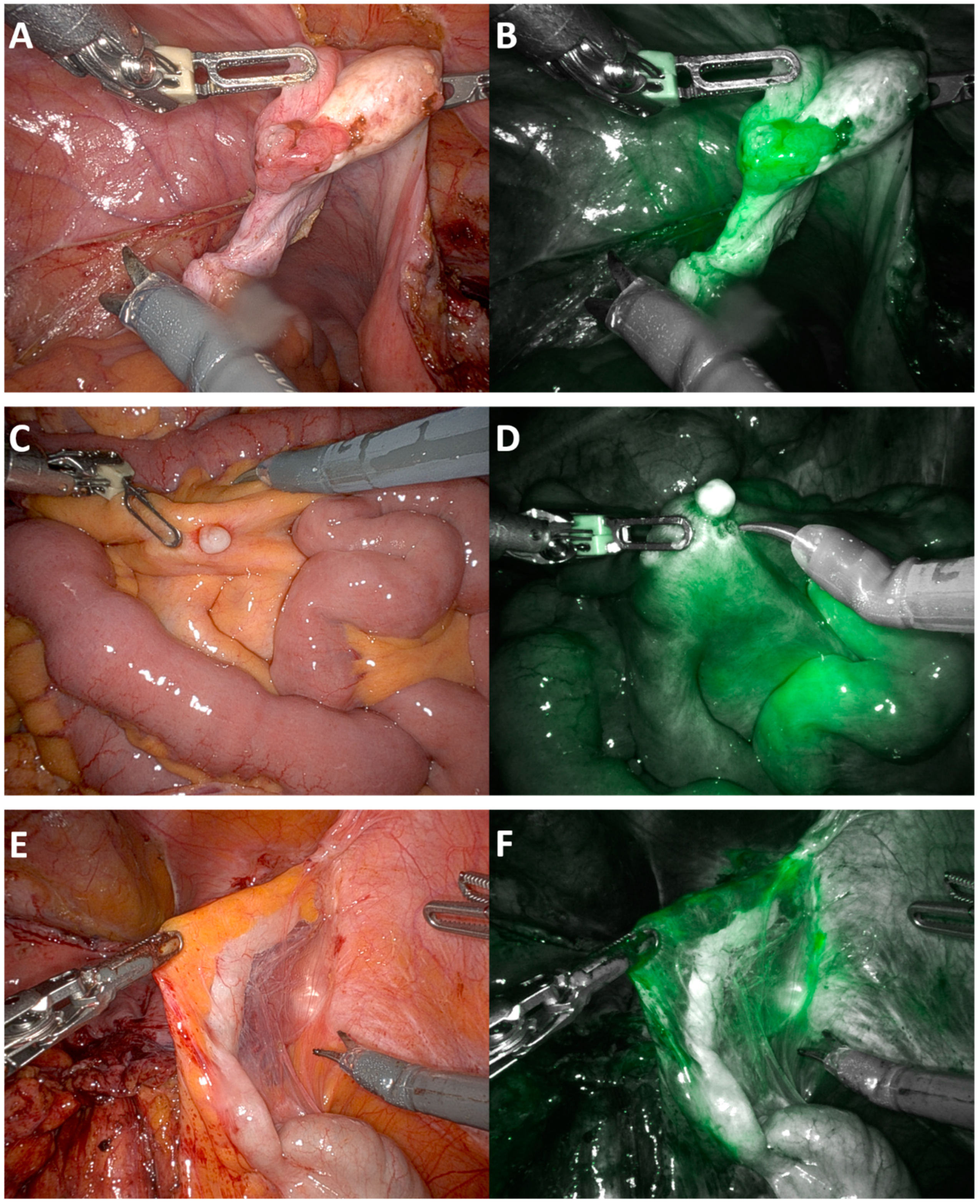 Cancers 16 02689 g002