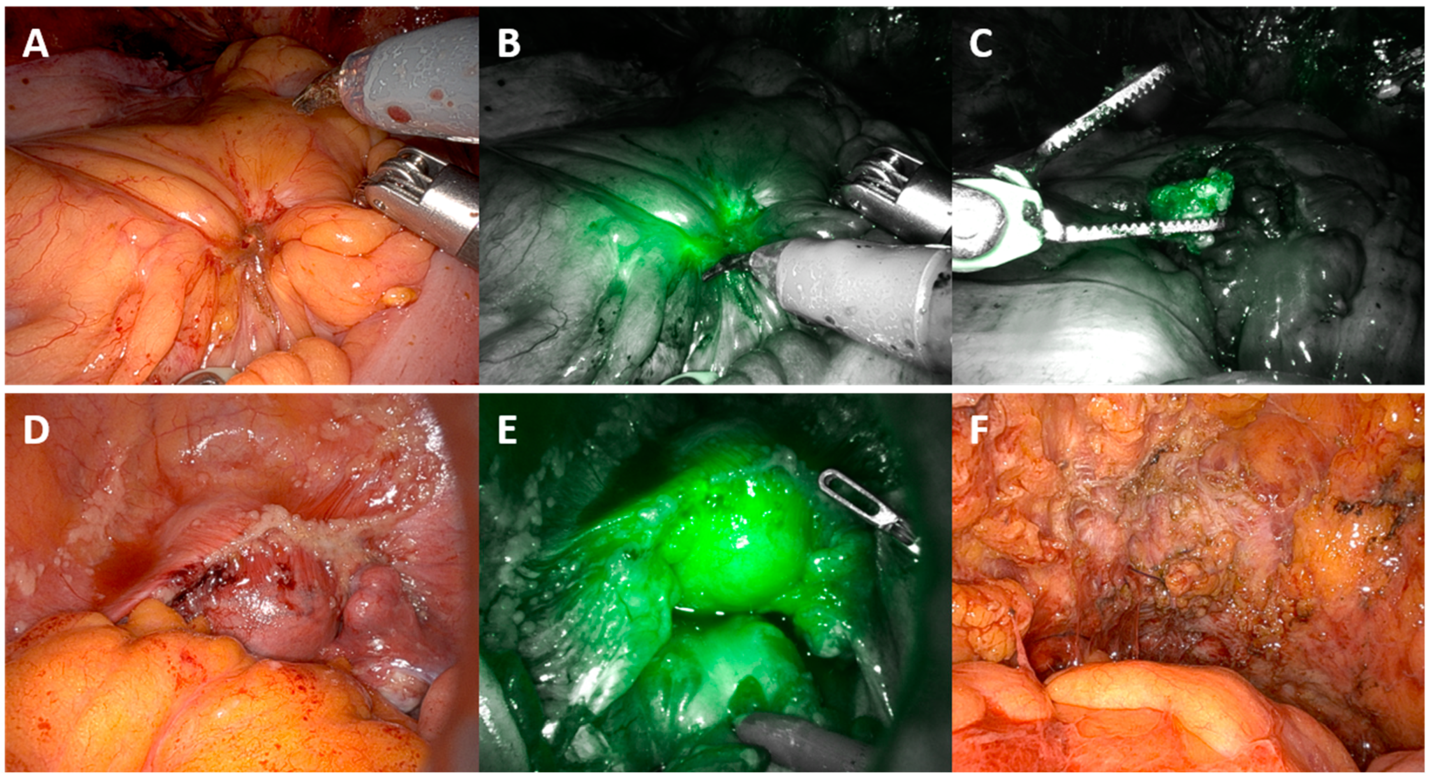 Cancers 16 02689 g003