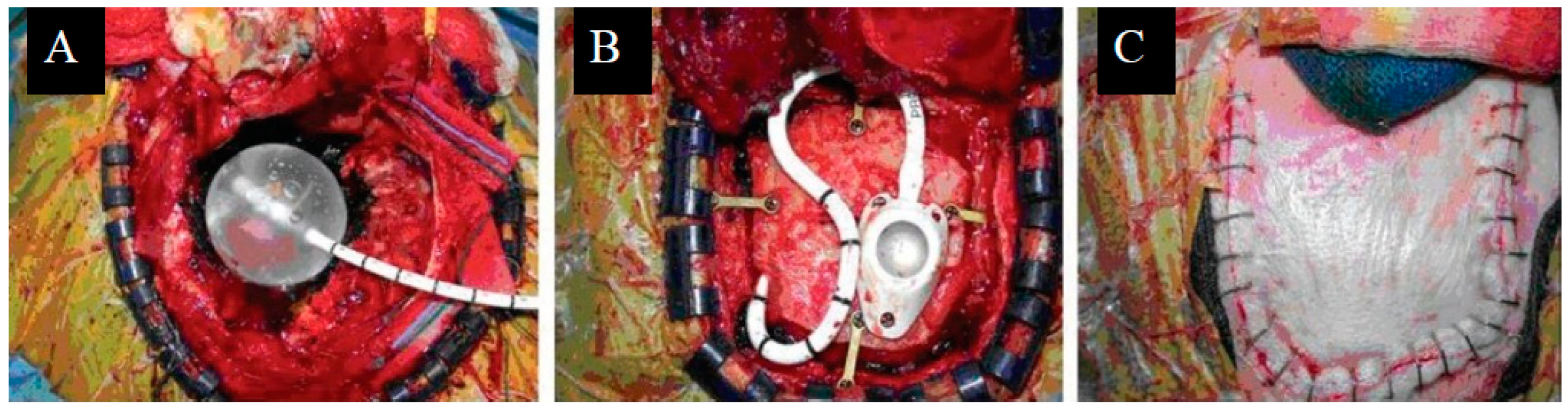 Cancers 16 02723 g002