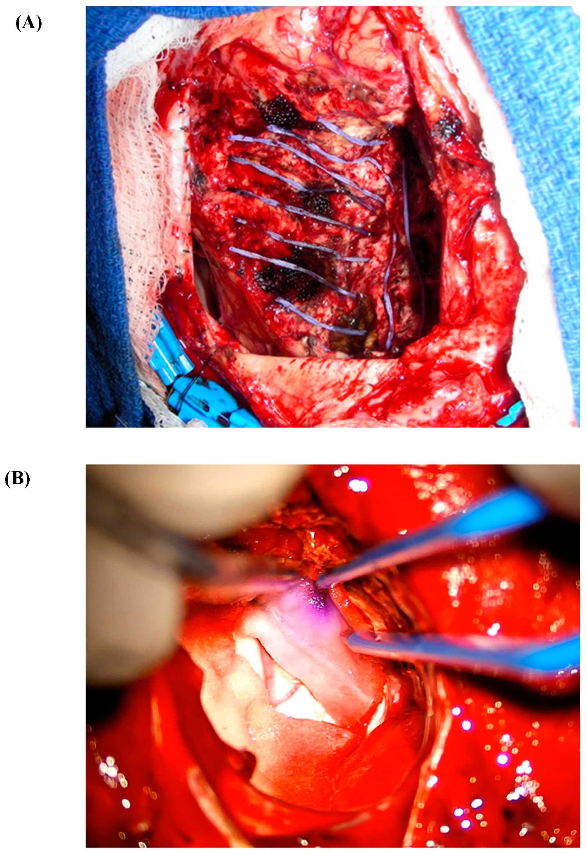 Cancers 16 02723 g003