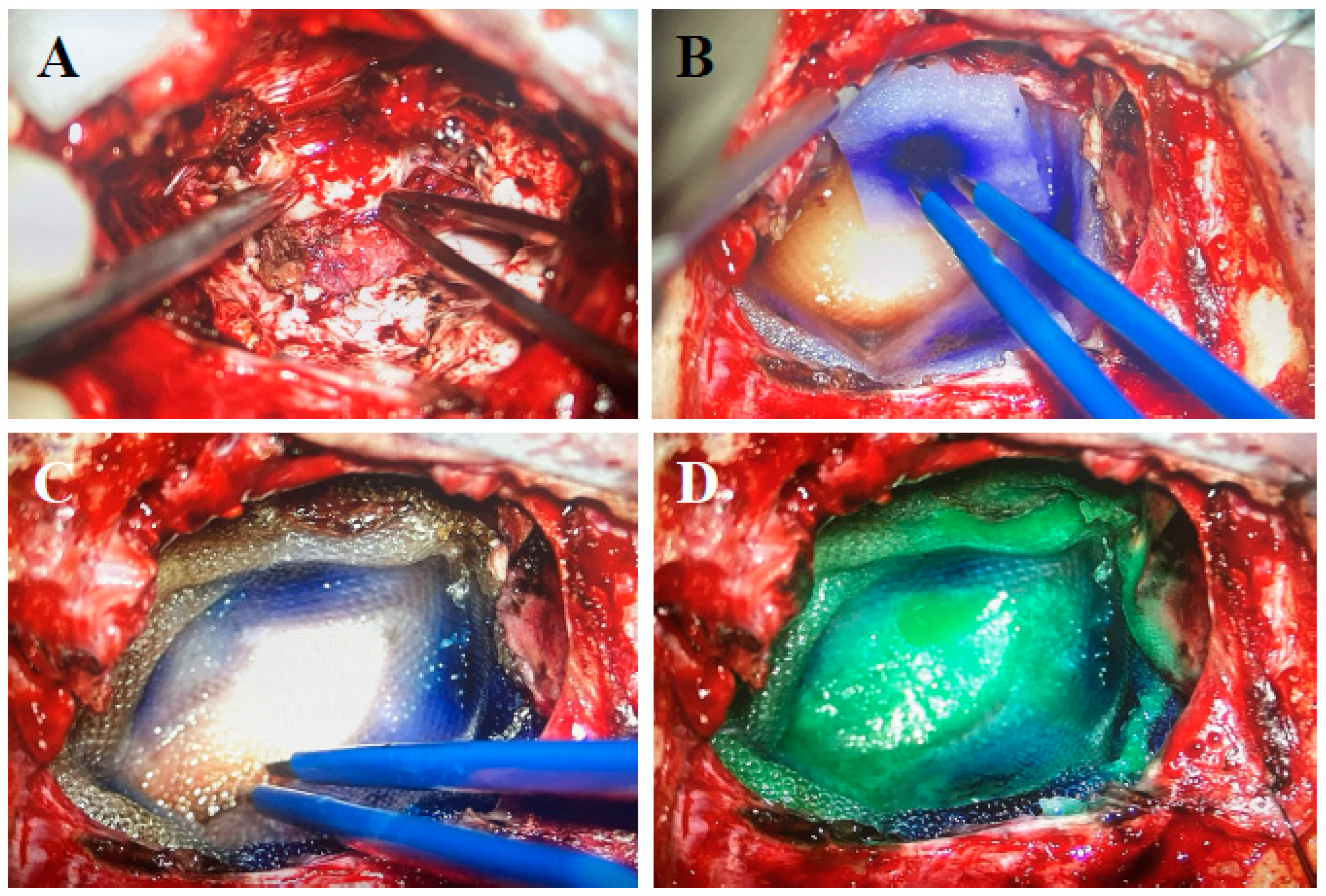 Cancers 16 02723 g004