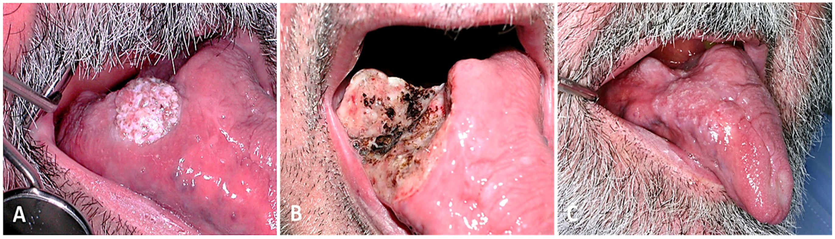 Cancers 16 02724 g002