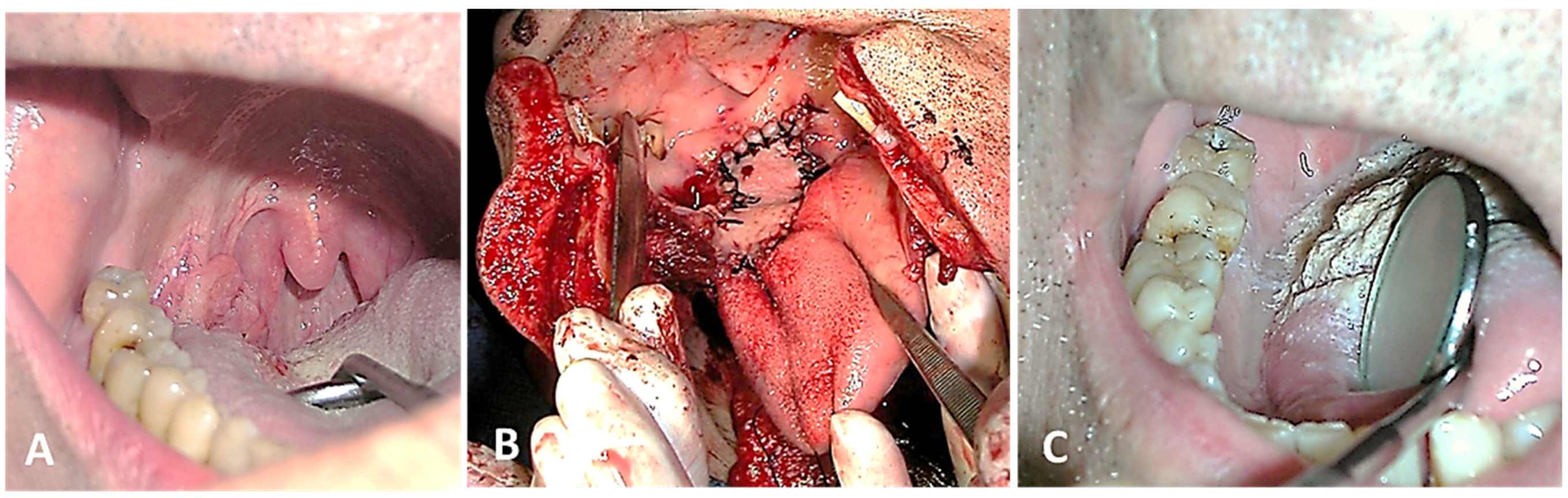 Cancers 16 02724 g003