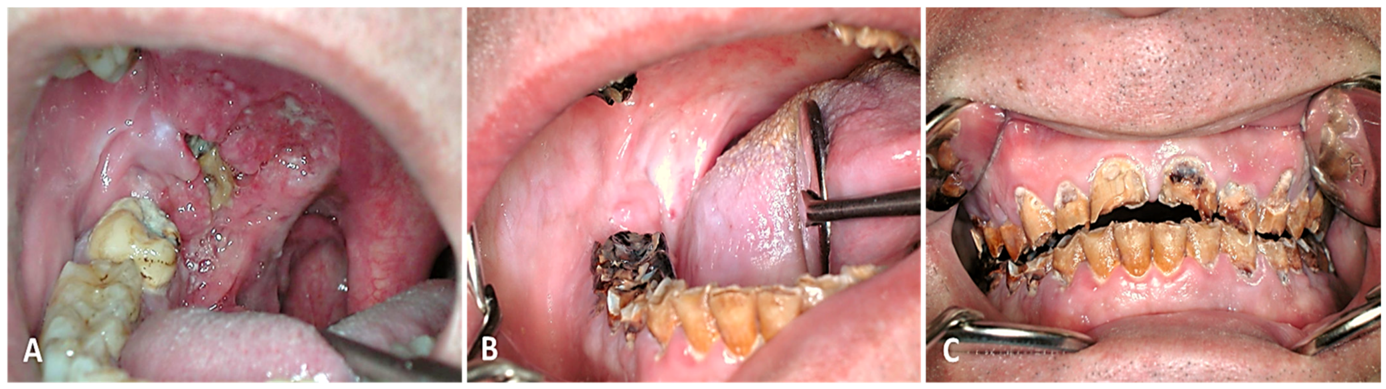 Cancers 16 02724 g004