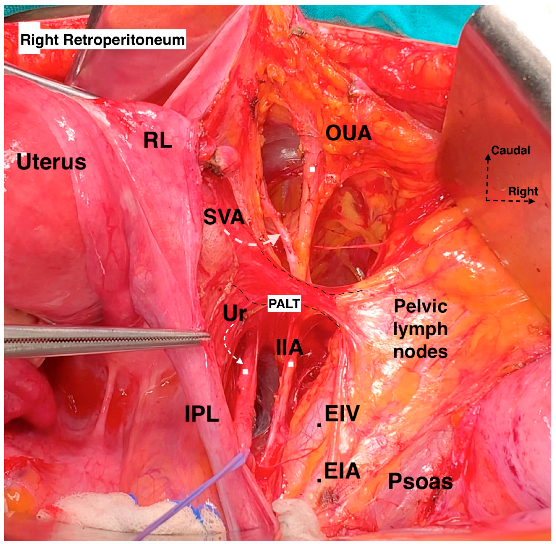 Cancers 16 02729 g003