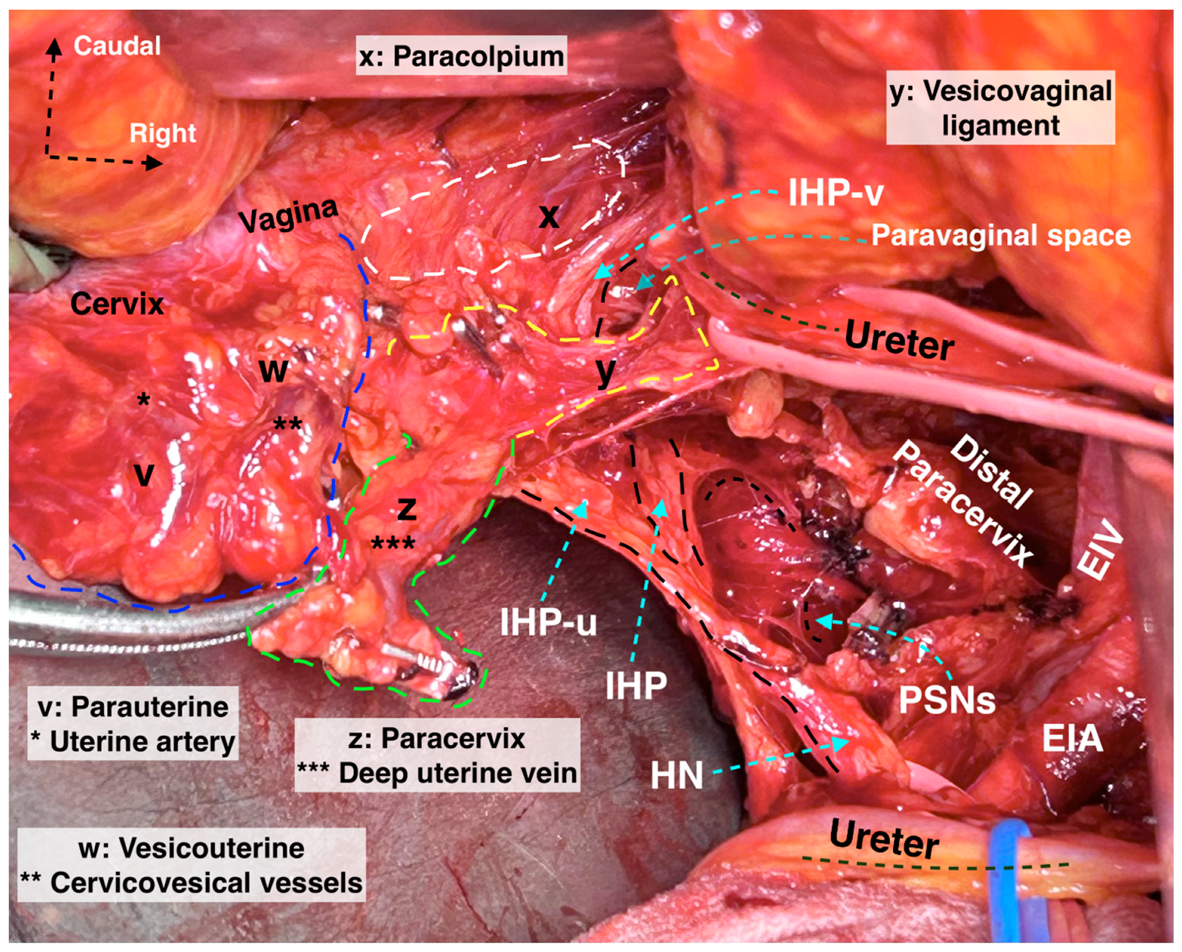 Cancers 16 02729 g005