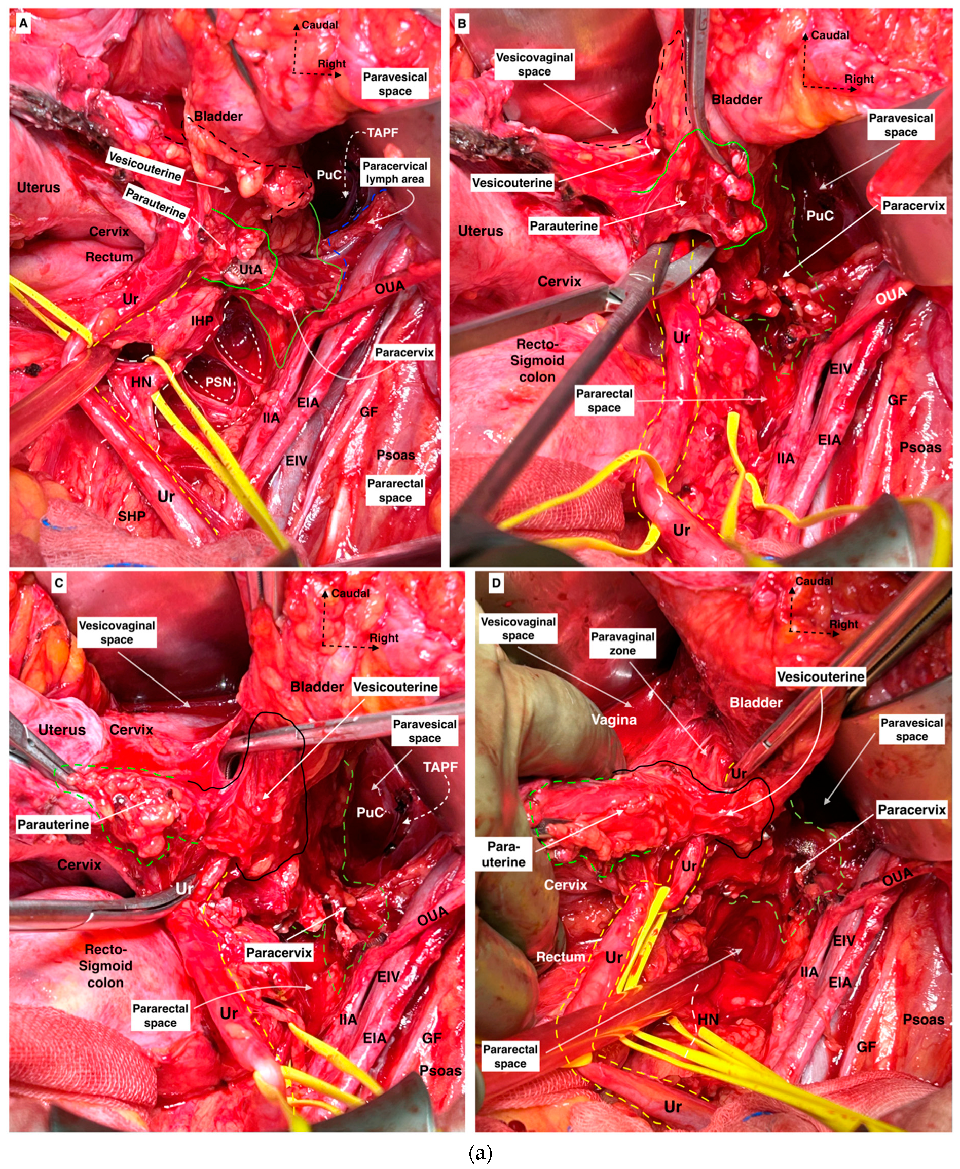 Cancers 16 02729 g007a