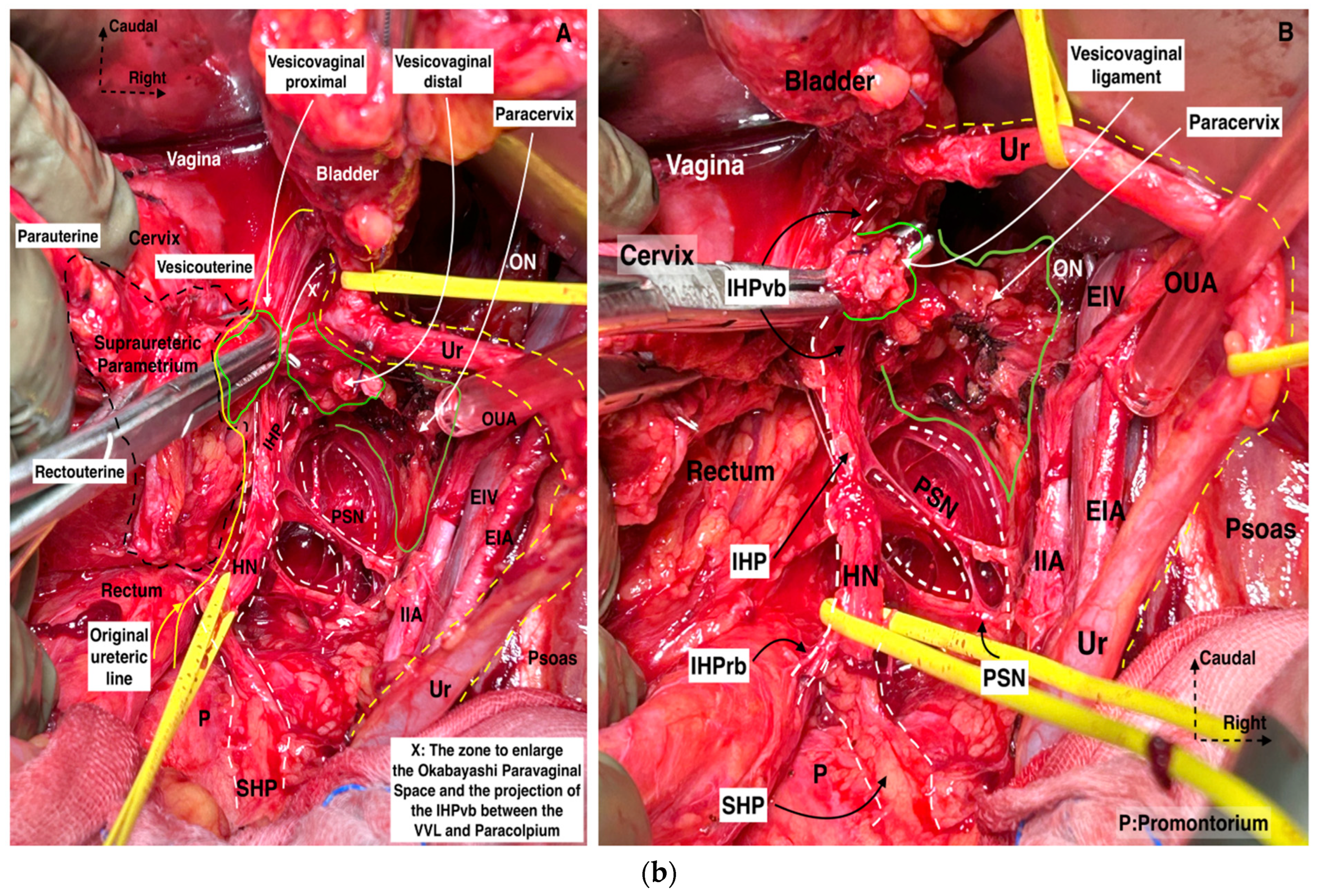 Cancers 16 02729 g007b