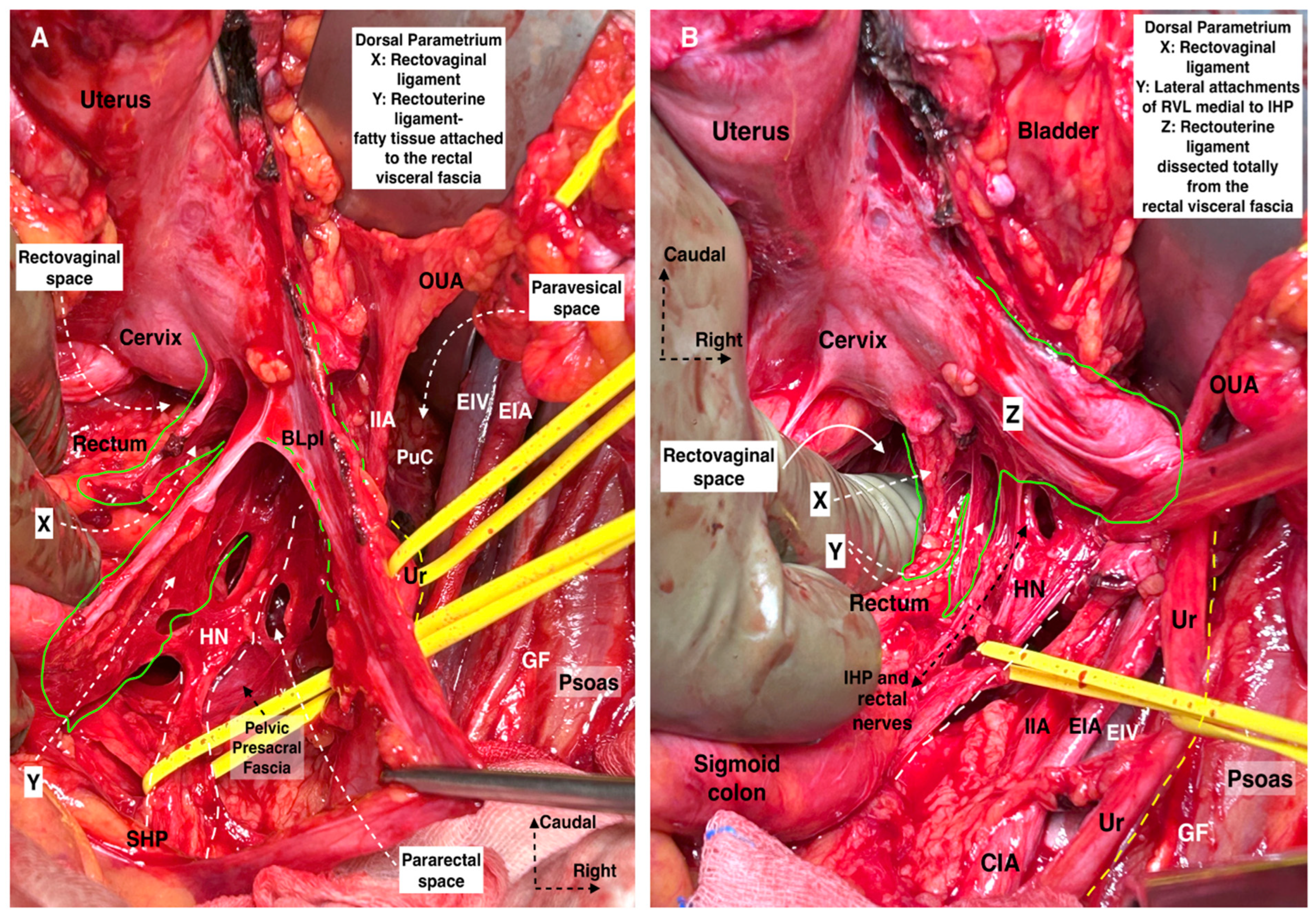 Cancers 16 02729 g008