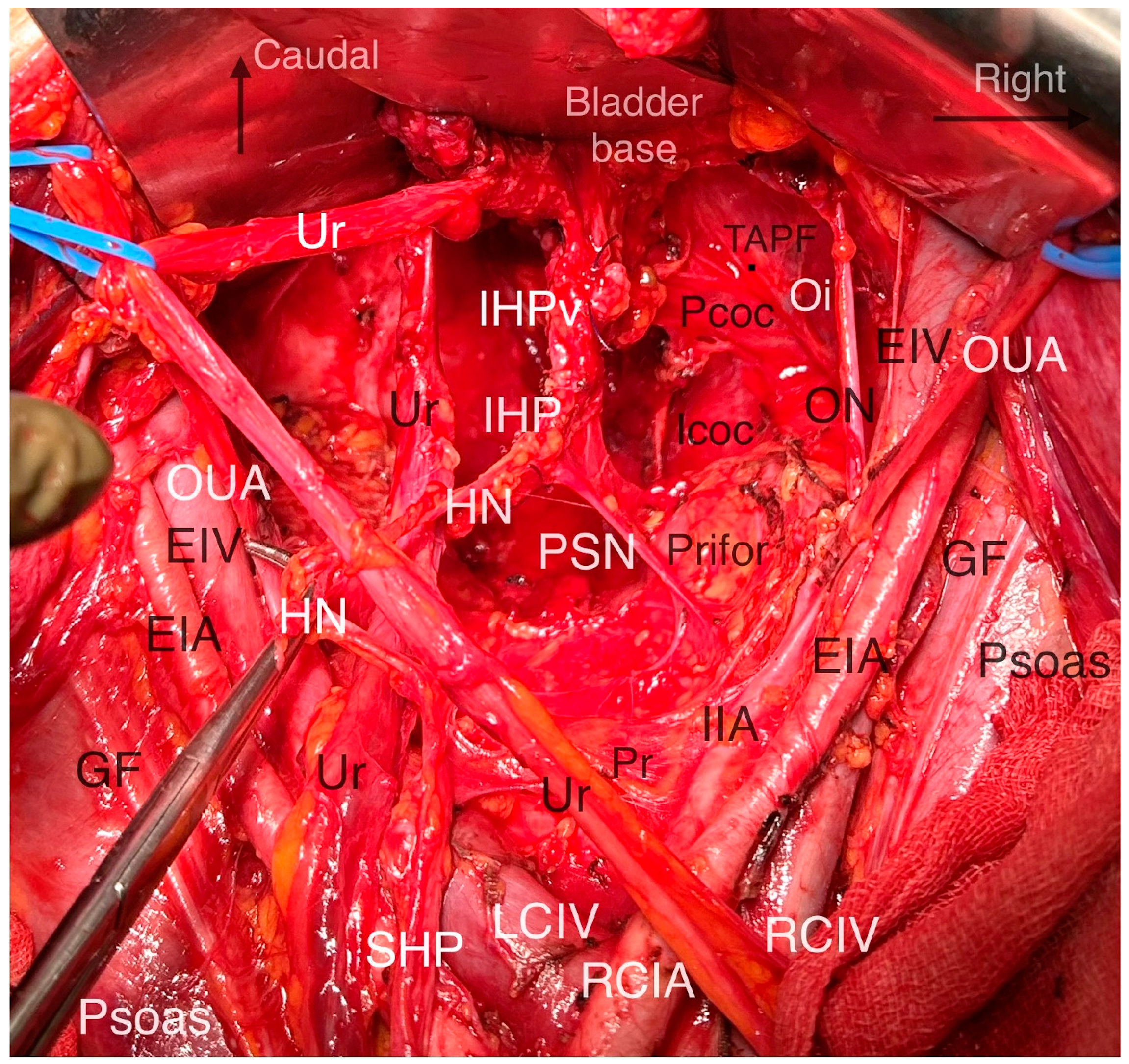 Cancers 16 02729 g010