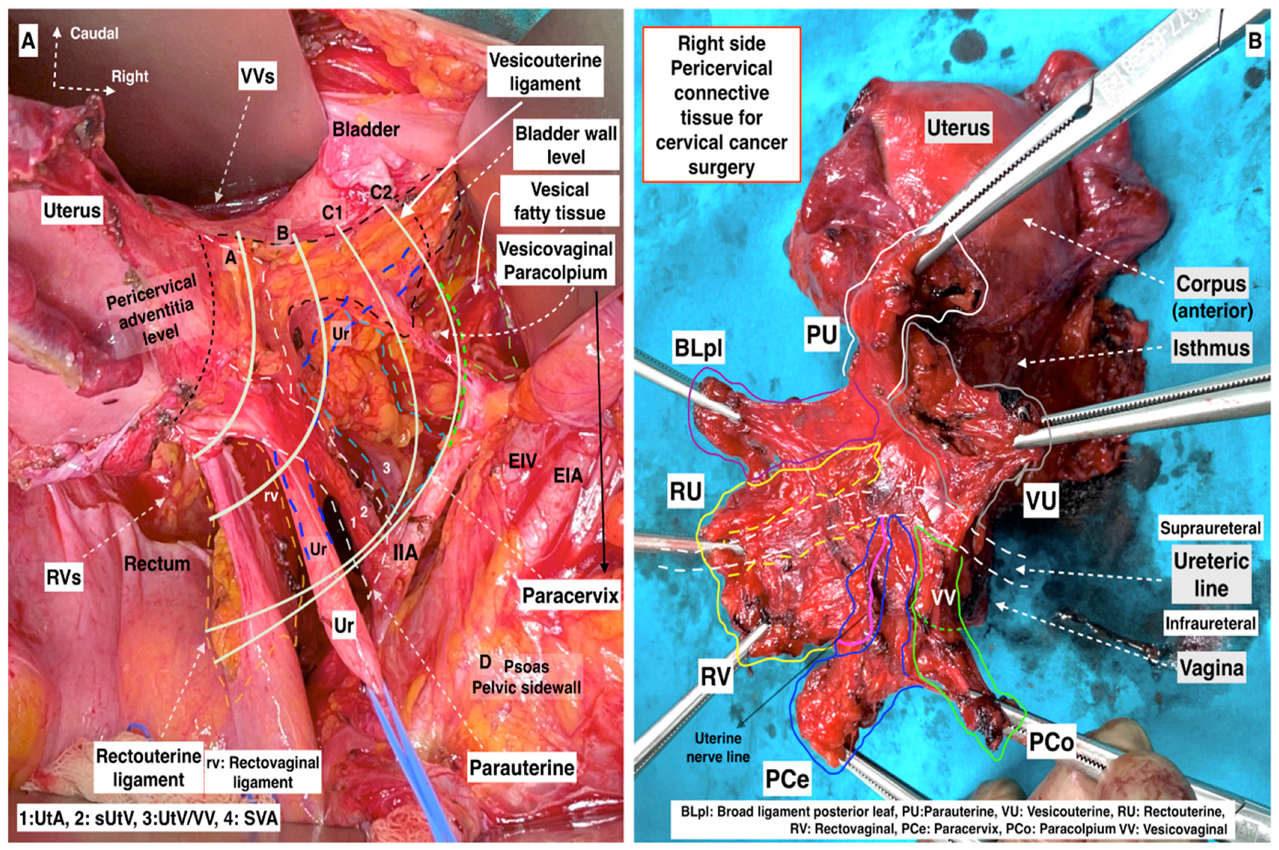 Cancers 16 02729 g011