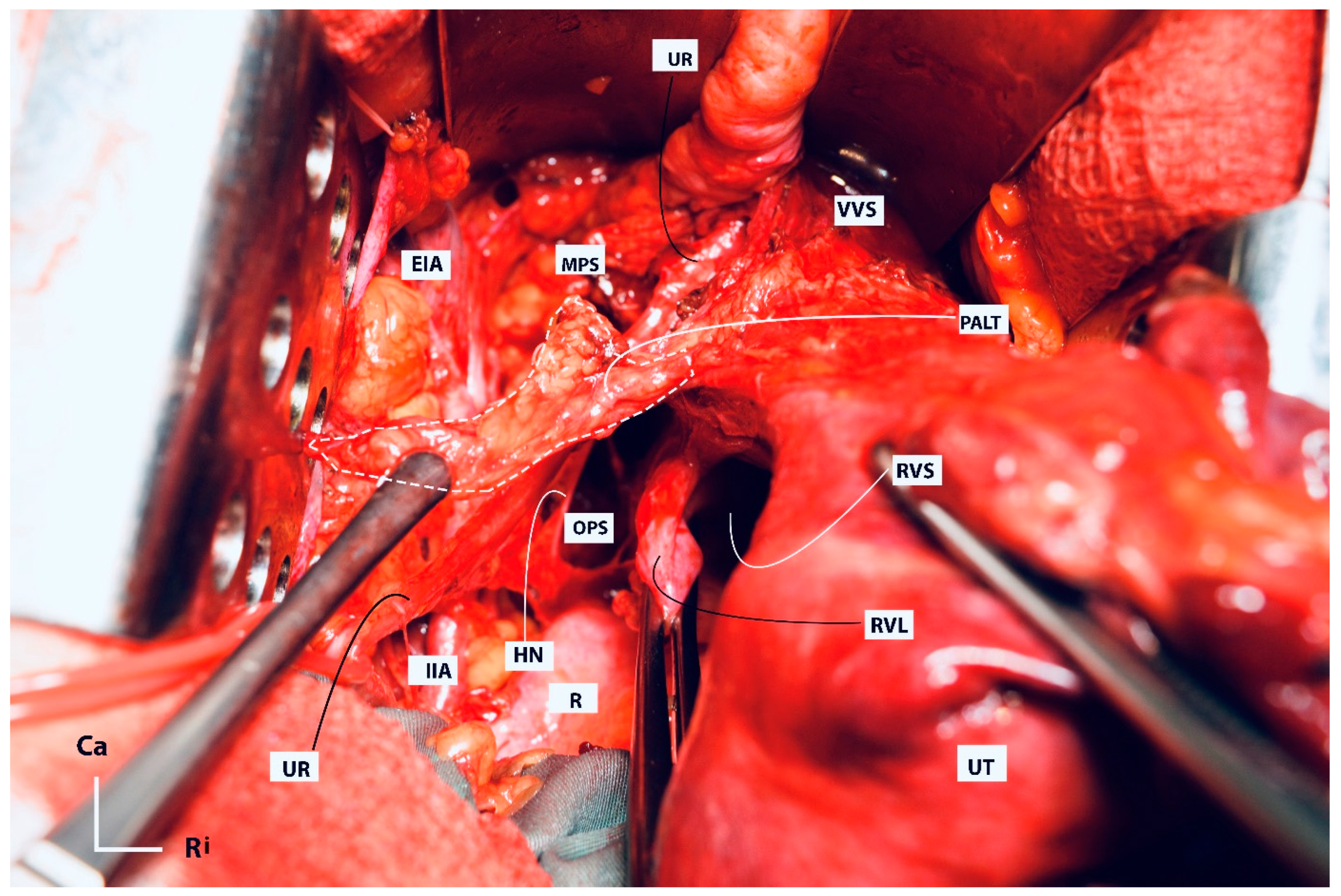 Cancers 16 02729 g012