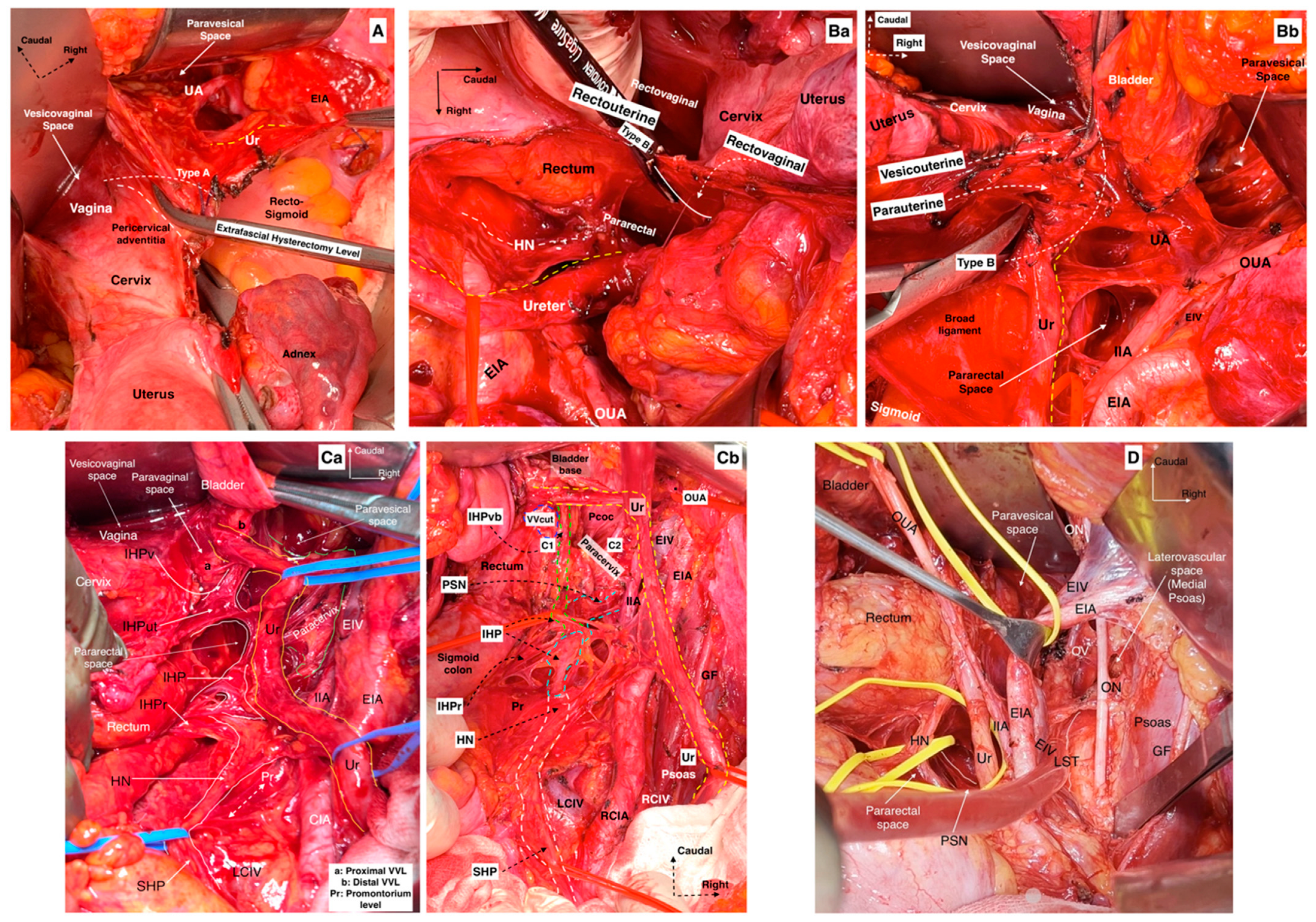 Cancers 16 02729 g013