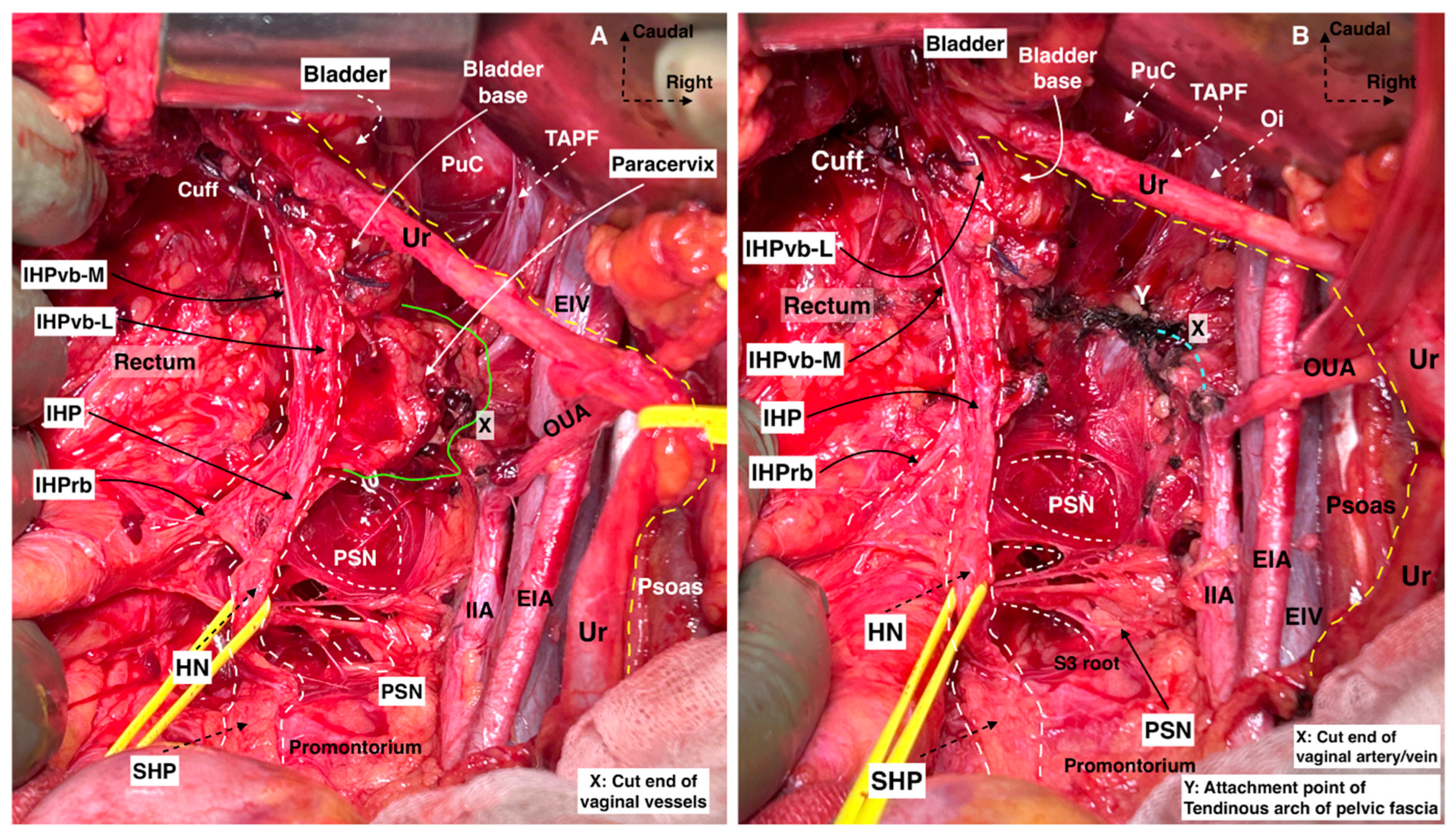 Cancers 16 02729 g014