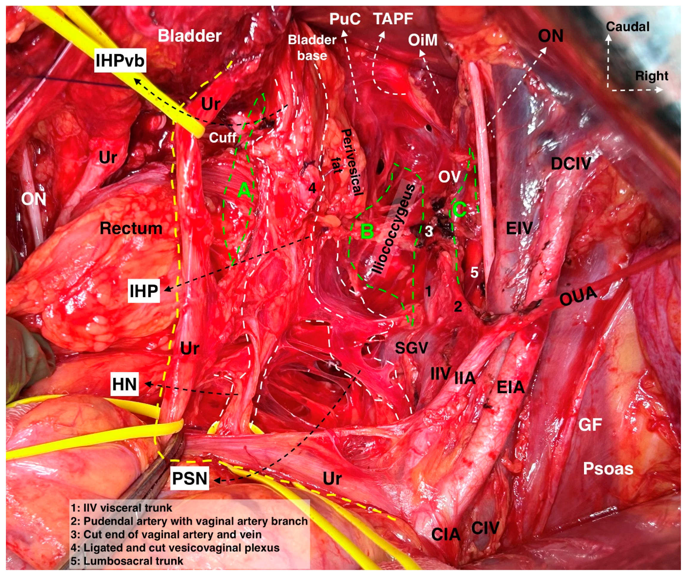 Cancers 16 02729 g015