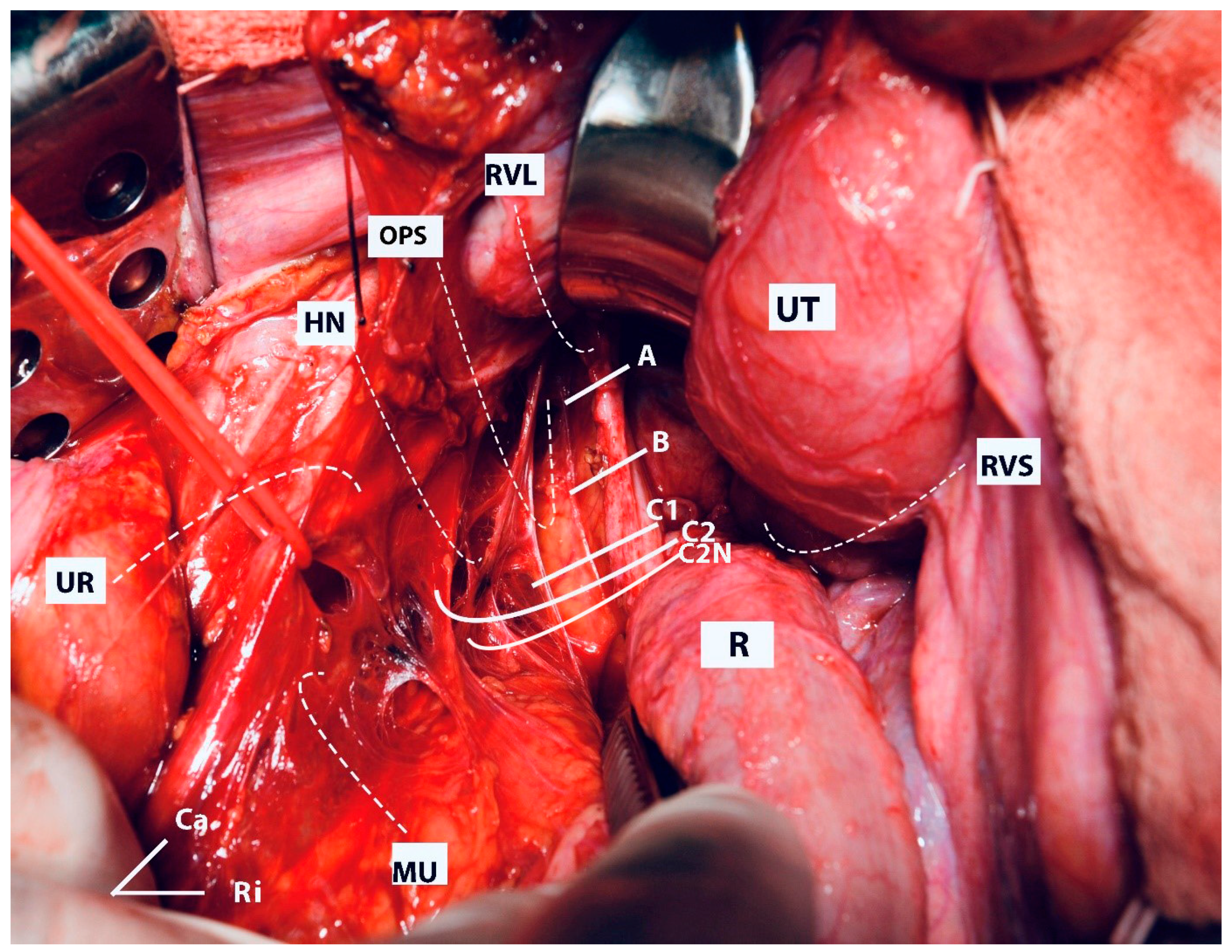 Cancers 16 02729 g017