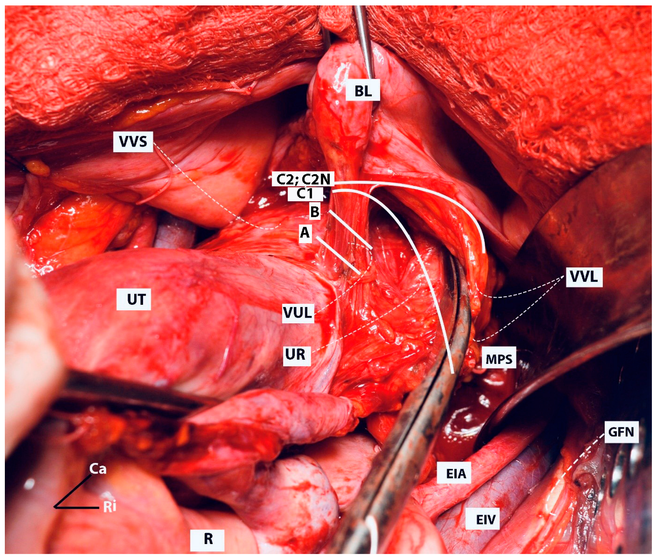Cancers 16 02729 g018