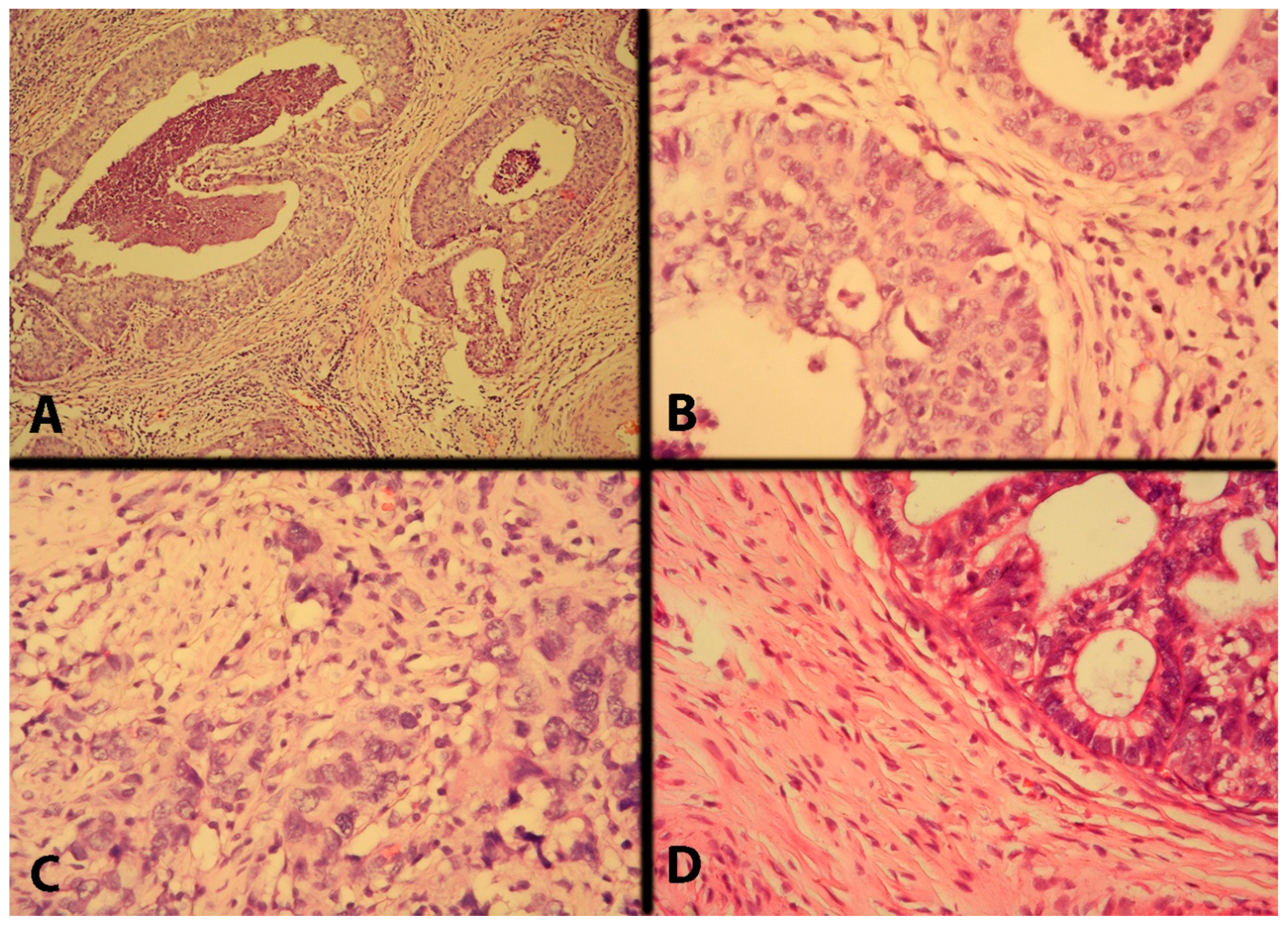 Cancers 16 02729 g019