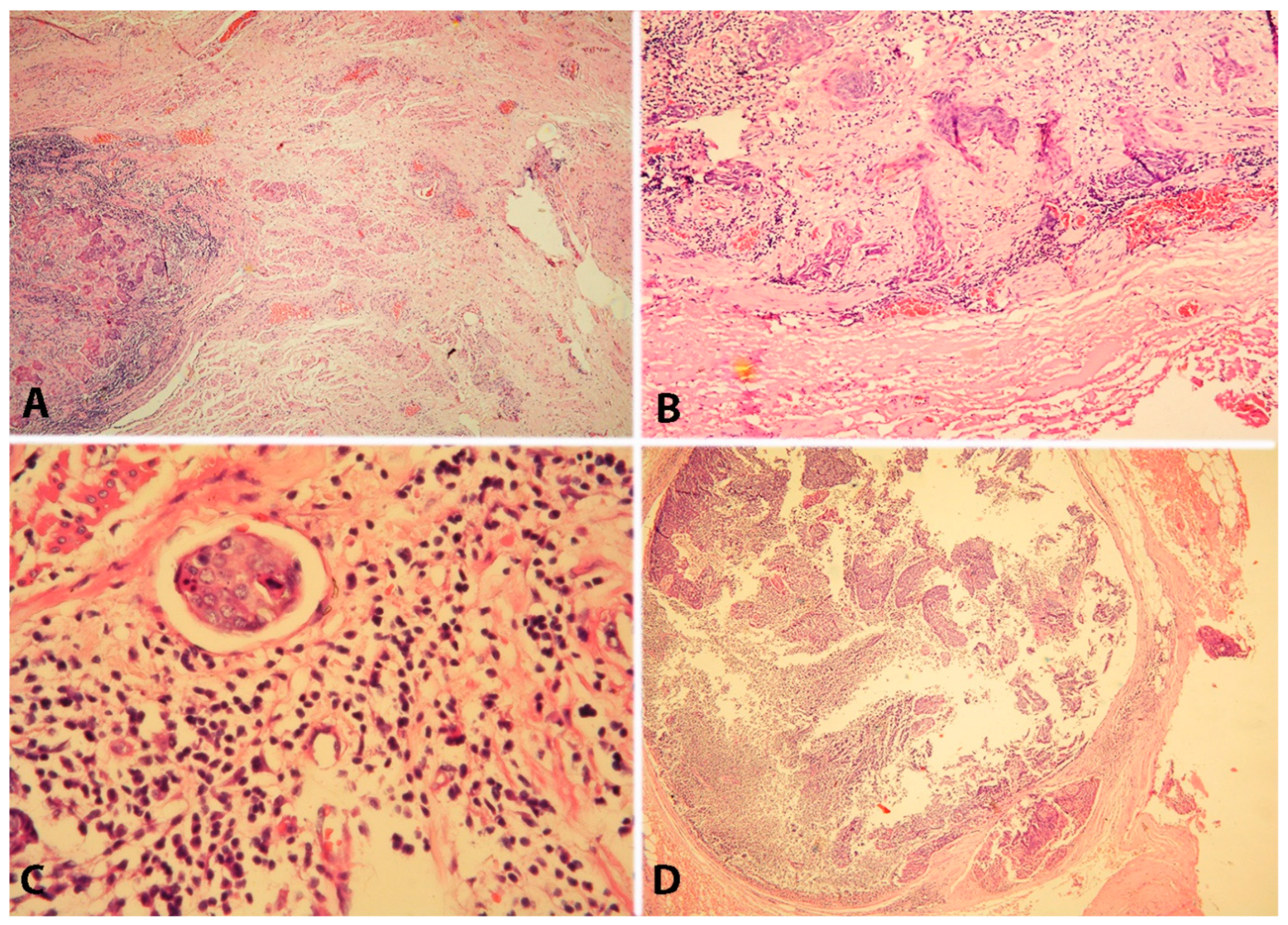 Cancers 16 02729 g020