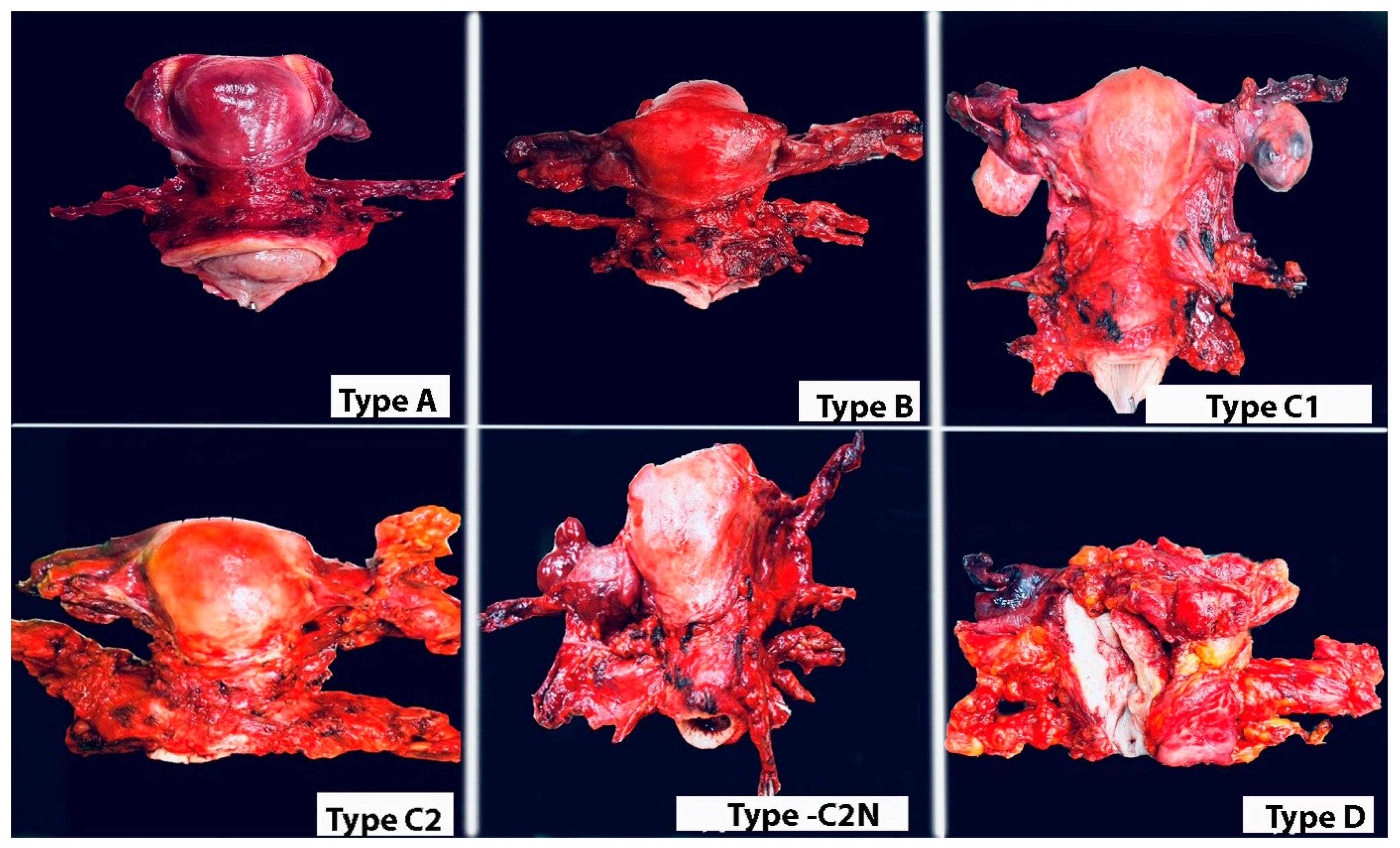 Cancers 16 02729 g021