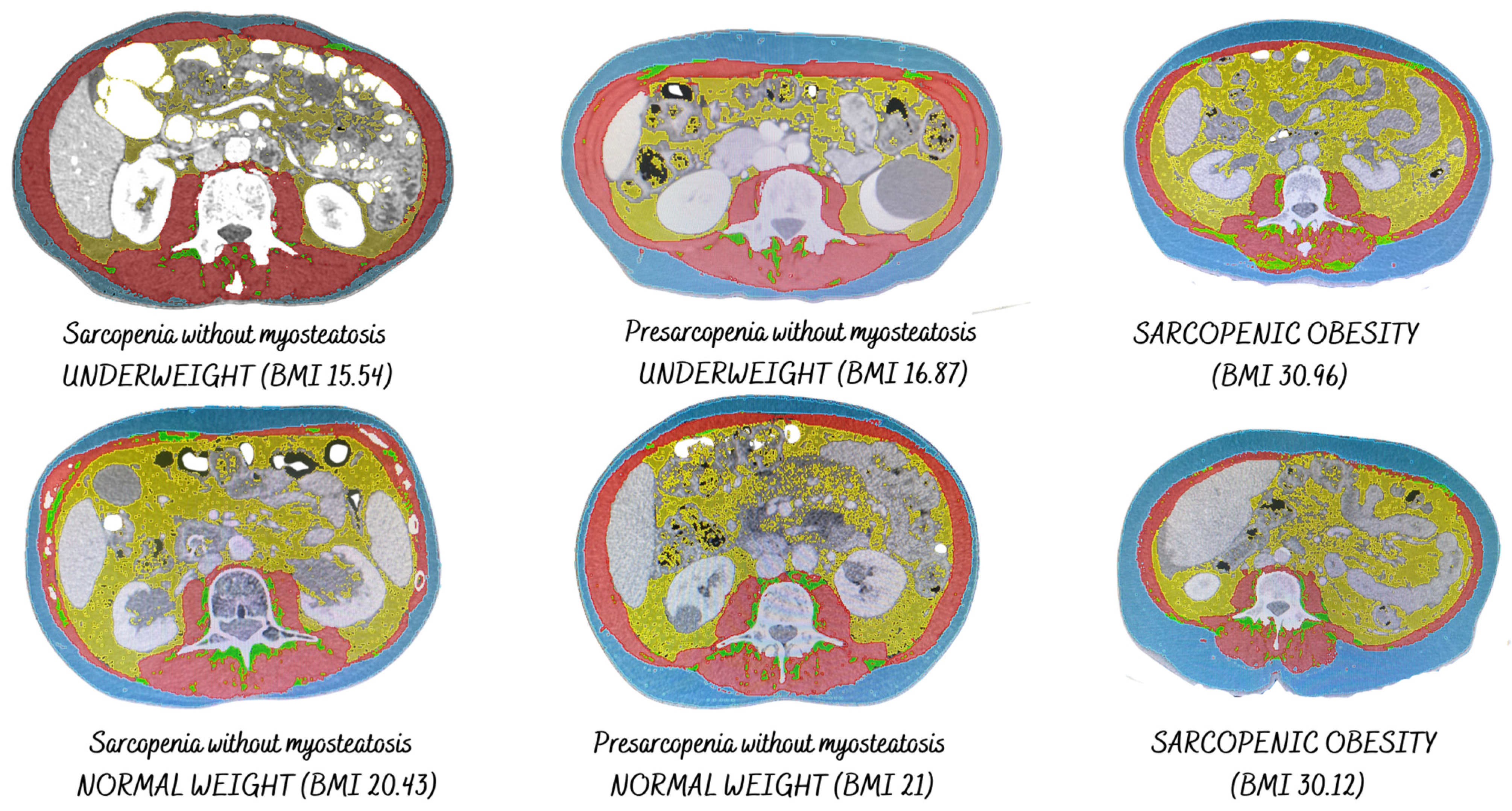 Cancers 16 02738 g002