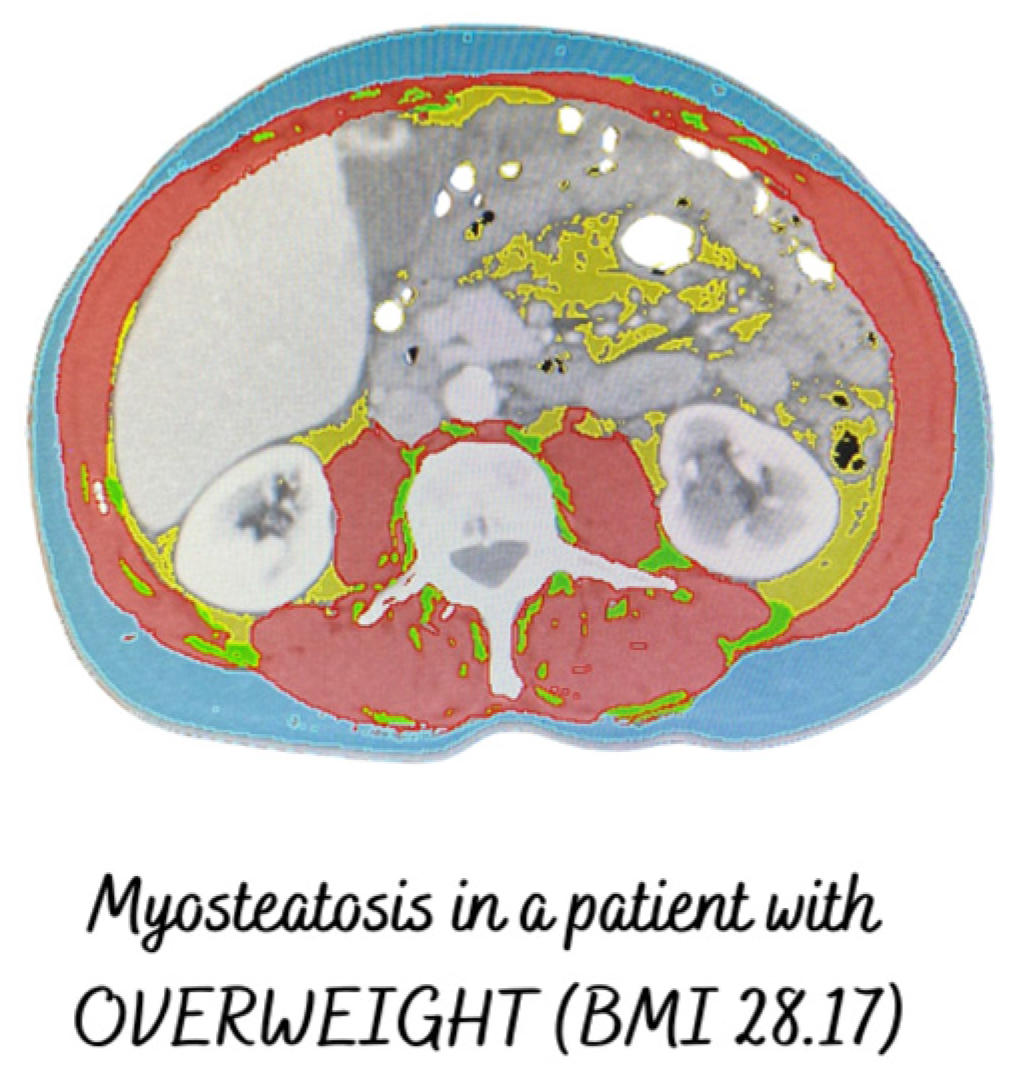 Cancers 16 02738 g003