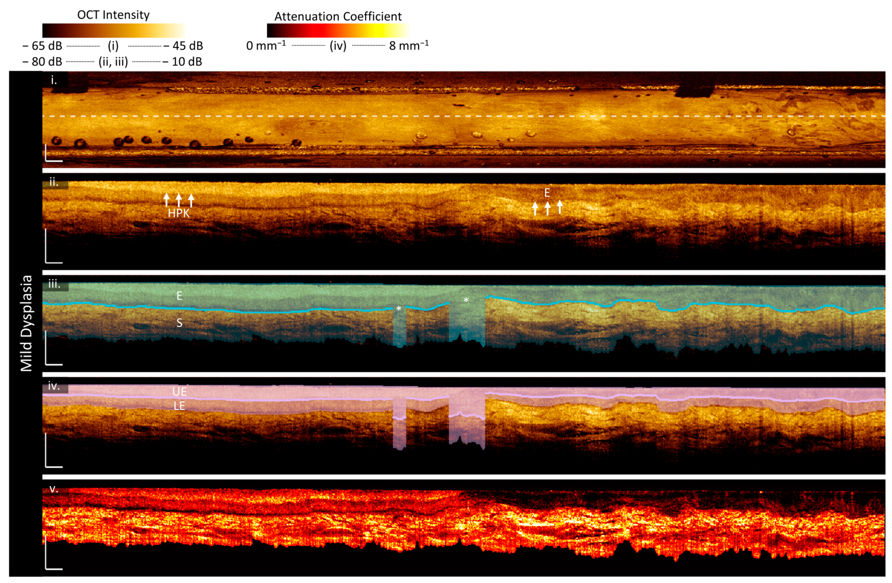 Cancers 16 02751 g003 Cancers 16 02751 g003