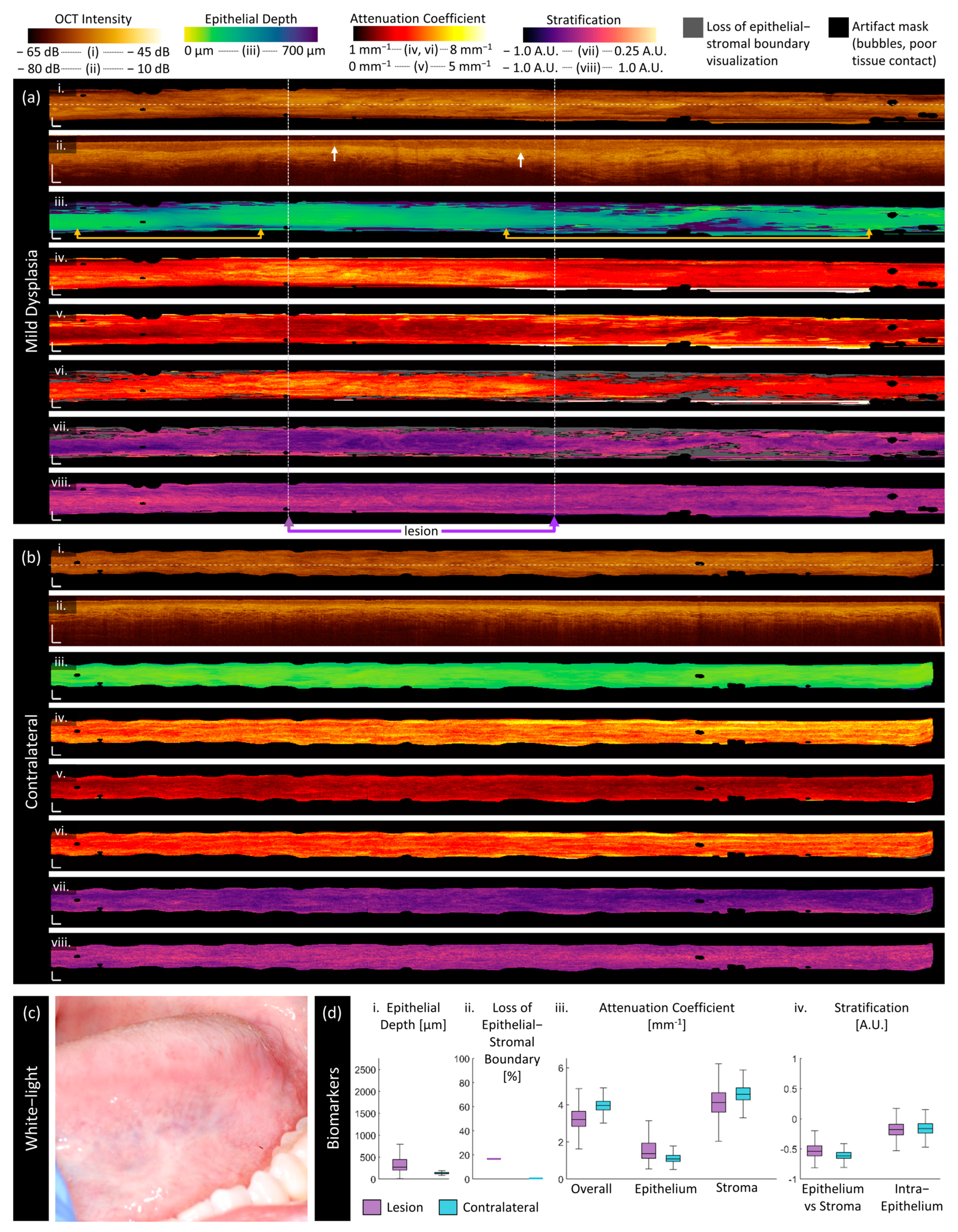 Cancers 16 02751 g005 Cancers 16 02751 g005