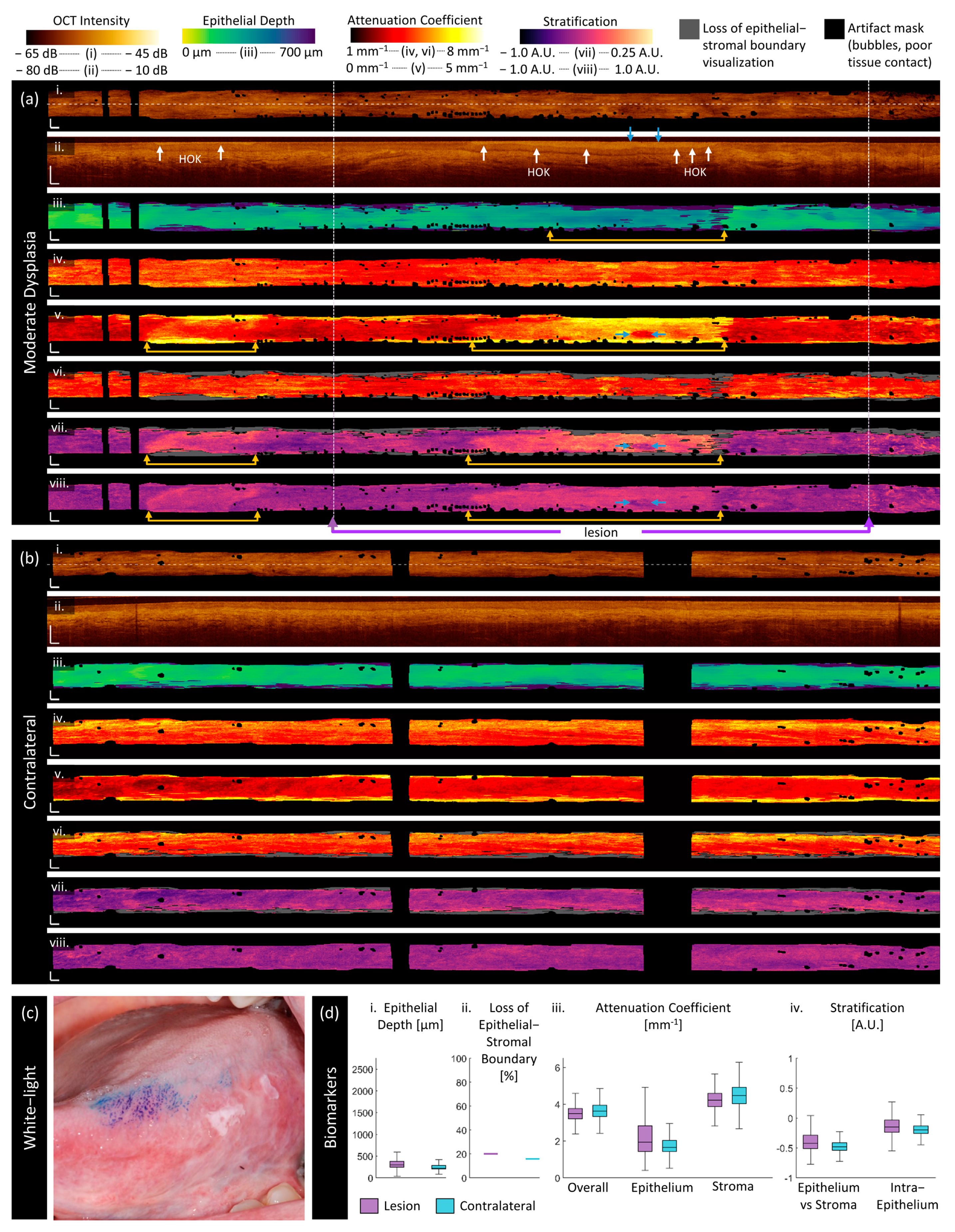 Cancers 16 02751 g006 Cancers 16 02751 g006