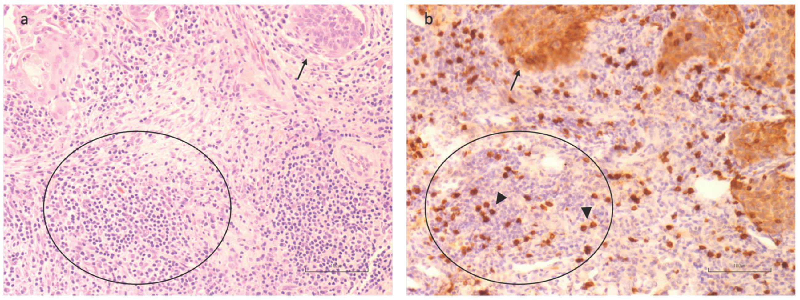 Cancers 16 02759 g008